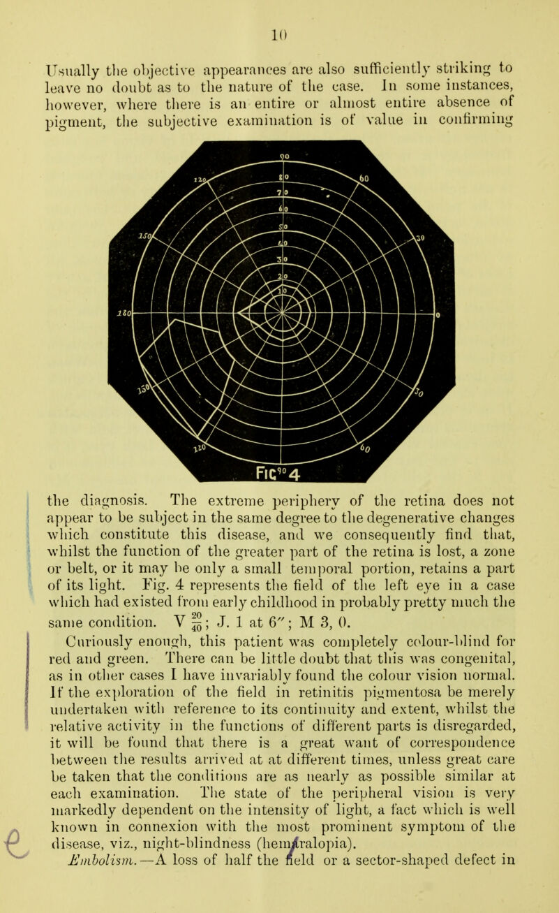 Usually the objective appearances are also sufficiently striking to leave no doubt as to the nature of the case. In some instances, however, where tliere is an entire or almost entire absence of pigment, the subjective examination is of value in confirming the diagnosis. Tlie extreme periphery of the retina does not appear to be subject in the same degree to the degenerative changes which constitute this disease, and we consequently find that, whilst the function of the greater part of the retina is lost, a zone or belt, or it may be only a small temporal portion, retains a part of its light. Fig. 4 represents the field of tlie left eye in a case which had existed I'rom early childhood in probably pretty much the same con dition. V ^; J. 1 at 6''; M 3, 0. Curiously enough, this patient was completely ccdour-blind for red and green. There can be little doubt that this was congenital, as in other cases I have invariablv found the colour vision normal. If the exploration of the field in retinitis pigmentosa be merely undertaken with reference to its continuity and extent, whilst the relative activity in the functions of different parts is disregarded, it will be found that there is a great want of correspondence between tlie results arrived at at different times, unless great care be taken that the conditions are as nearly as possible similar at each examination. The state of the peripheral vision is very markedly dependent on the intensity of light, a fact which is well known in connexion with the most prominent symptom of the disease, viz., night-blindness (heni/ralopia). Embolism.—A loss of half the neld or a sector-shaped defect in
