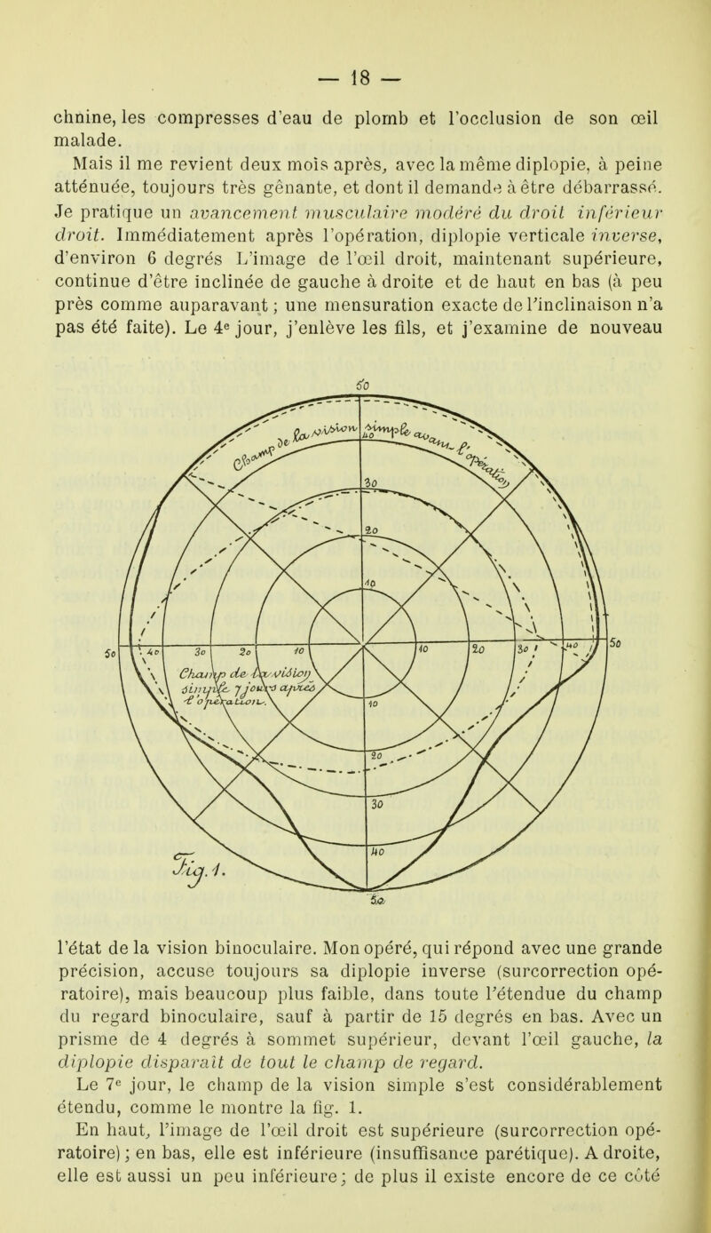 chnine, les compresses d'eau de plornb et l'occlusion de son œil malade. Mais il me revient deux mois après, avec la même diplopie, à peine atténuée, toujours très gênante, et dont il demande à être débarrassé. Je pratique un avancement musculaire modéré du droit inférieur droit. Immédiatement après l'opération, diplopie verticale inverse, d'environ 6 degrés L'image de l'œil droit, maintenant supérieure, continue d'être inclinée de gauche à droite et de haut en bas (à peu près comme auparavant; une mensuration exacte de l'inclinaison n'a pas été faite). Le 4e jour, j'enlève les fils, et j'examine de nouveau l'état delà vision binoculaire. Mon opéré, qui répond avec une grande précision, accuse toujours sa diplopie inverse (surcorrection opé- ratoire), mais beaucoup plus faible, dans toute l'étendue du champ du regard binoculaire, sauf à partir de 15 degrés en bas. Avec un prisme de 4 degrés à sommet supérieur, devant l'œil gauche, la diplopie disparaît de tout le champ de regard. Le 7e jour, le champ de la vision simple s'est considérablement étendu, comme le montre la fig. 1. En haut, l'image de l'œil droit est supérieure (surcorrection opé- ratoire) ; en bas, elle est inférieure (insuffisance parétique). Adroite, elle est aussi un peu inférieure; de plus il existe encore de ce côté