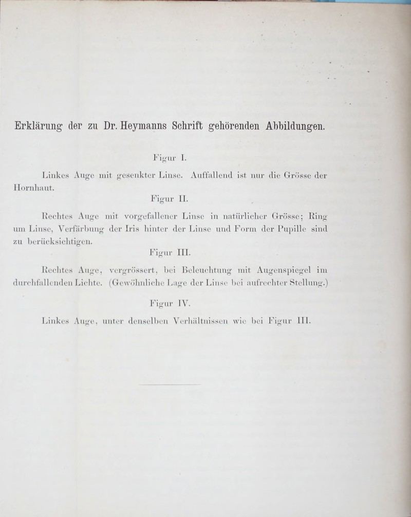 Erklärung der zu Dr. Heymanns Schrift gehörenden Abbildungen. Fi-iir 1. Linkt'S Auiic mit «icsoiikfer Linse. Aiillalleiid ist nur die Grösse der 1 loniliaut. Fi-i.r IL l*i'c]iti < AiiLic mit \-<)rL:clalli ih T Linse in natiirliclier fTrössc; Ring- inn Linse. \'ert;ii l)unn' der lias liinter der Linse ini<l I'^nrm der Pu])ille sind zu Li riicksichtig-eii. Fi,-nr in. L'eelites Au^io, vi'r;:rösse!t. l)ei L)elenelitnnii' mit Aug-enspic<iel im dnrelit'allt nden Liclitc. (Gewölndiclie La^ie der Lin>r hei autVe(dit('r Stcllun«i-.) Fi-nr Linkes An;^-e. nni.r den>elli.ii W Mi>sen wie hei I'^iuiir IIL