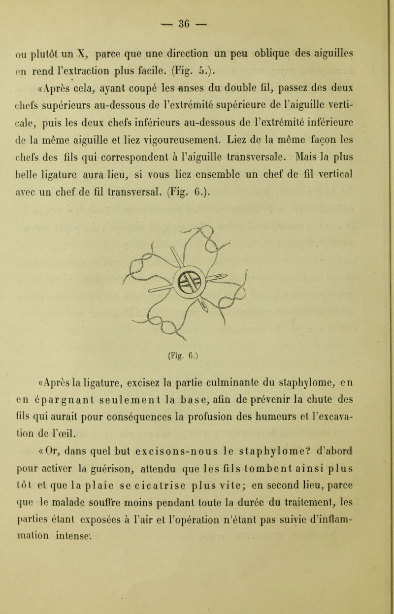 ou plutôt un X;, parce que une direction un peu oblique des aiguilles en rend l'extraction plus facile. (Fig. 5.). ((Après cek; ayant coupé les «uses du double fil, passez des deux chefs supérieurs au-dessous de Textrémité supérieure de Faiguille verti- cale, puis les deux chefs inférieurs au-dessous de l'extrémité inférieure de la même aiguille et liez vigoureusement. Liez de la même façon les chefs des fils qui correspondent à l'aiguille transversale. Mais la plus belle ligature aura lieu, si vous liez ensemble un chef de fil vertical avec un chef de fil transversal. (Fig. 6.). (Fig. 6.) «Après la ligature, excisez la partie culminante du staphylome, en en épargnant seulement la base, afin de prévenir la chute des fils qui aurait pour conséquences la profusion des humeurs et l'excava- tion de l'œil. ((Or, dans quel but excisons-nous le staphylome? d'abord pour activer la guérison, attendu que les fils tombent ainsi plus tôt et que la plaie se cicatrise plus vite; en second lieu, parce que le malade souflre moins pendant toute la durée du traitement, les parties étant exposées à l'air et l'opération n'étant pas suivie d'inflam- mation intense*.