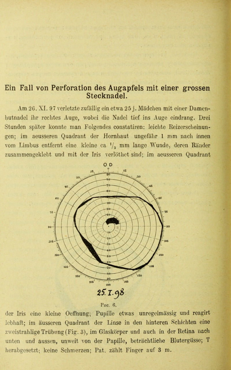 Ein Fall von Perforation des Augapfels mit einer grossen Stecknadel. Am 2G. XI. 97 verletzte zufällig ein etwa 25 j. Mädchen mit einer Damon- hutnadel ihr rechtes Auge, wobei die Nadel tief ins Auge eindrang. Drei Stunden später konnte man Folgendes constatiren: leichte Reizerscheinun- gen; im aeusseren Quadrant der Hornhaut ungefähr 1 mm nach innen vom Limbus entfernt eine kleine ca 7^ mm lange Wunde, deren Ränder zusammengeklebt und mit der Iris verlöthet sind; im aeusseren Quadrant O D Piic. 6. der Iris eine klehie Oeffnung; Pupille etwas unregelmässig und reagirt lebhaft; im äusseren Quadrant der Linse in den hinteren Schichten eine zweistrahlige Trübung (Fig. 3), im Glaskörper und auch in der Retina nach unten und aussen, unweit von der Papille, beträchtliche Blutergüsse; T herabgesetzt; keine Schmerzen; Pat. zählt Finger auf 3 m.