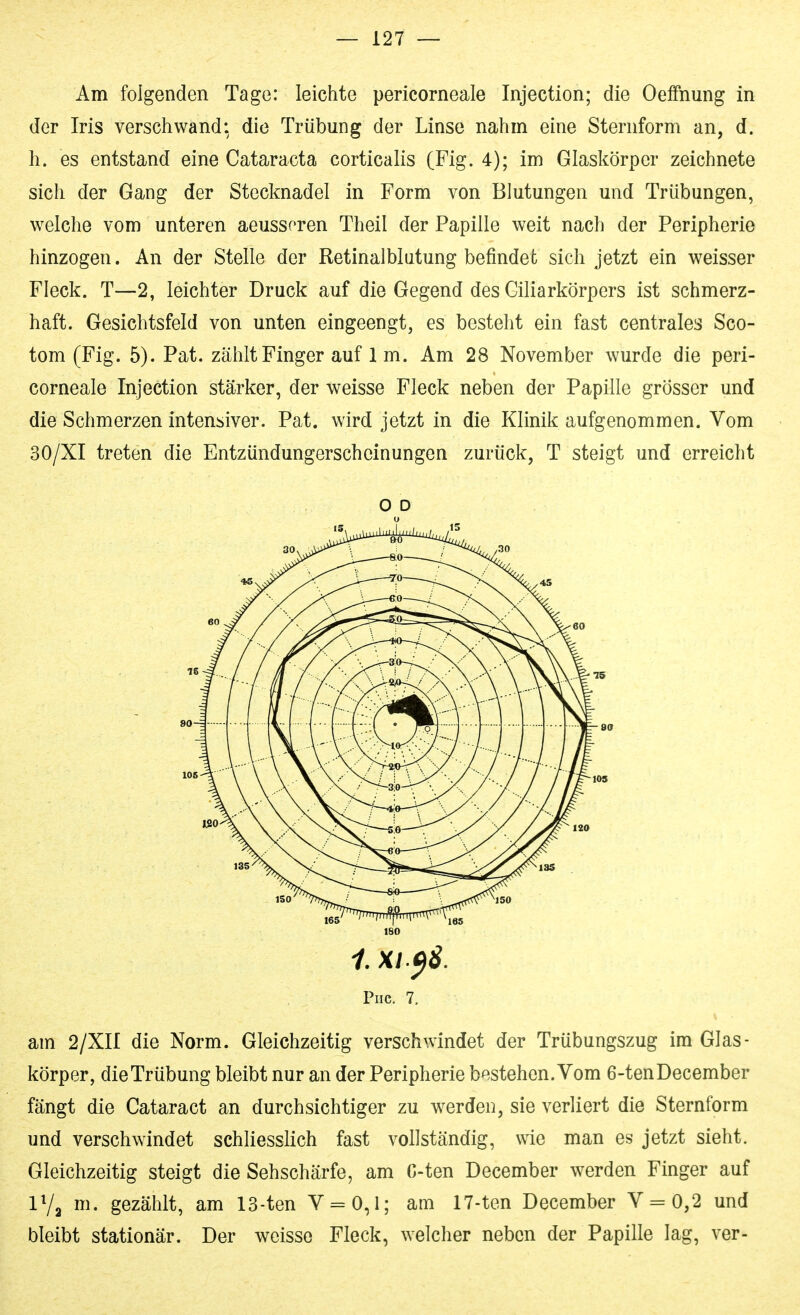 Am folgenden Tage: leichte pericorneale Injection; die OefFnung in der Iris verschwand: die Trübung der Linse nahm eine Steniform an, d. h. es entstand eine Cataracta corticalis (Fig. 4); im Glaskörper zeichnete sich der Gang der Stecknadel in Form von Blutungen und Trübungen, welche vom unteren aeussoren Theil der Papille weit nach der Peripherie hinzogen. An der Stelle der Retinalblutung befindet sich jetzt ein weisser Fleck. T—2, leichter Druck auf die Gegend des Ciliarkörpers ist schmerz- haft. Gesichtsfeld von unten eingeengt, es besteht ein fast centrales Sco- tom (Fig. 5). Pat. zählt Finger auf 1 m. Am 28 November wurde die peri- corneale Injection stärker, der weisse Fleck neben der Papille grösser und die Schmerzen intensiver. Pat. wird jetzt in die Klinik aufgenommen. Vom 30/XI treten die Entzündungerscheinungen zurück, T steigt und erreicht O D 180 1. XI.^8. Piic. 7. am 2/XII die Norm. Gleichzeitig verschwindet der Trübungszug im Glas- körper, die Trübung bleibt nur an der Peripherie bestehen. Vom 6-tenDecember fängt die Cataract an durchsichtiger zu werden, sie verliert die Sternform und verschwindet schliesslich fast vollständig, wie man es jetzt sieht. Gleichzeitig steigt die Sehschärfe, am G-ten December werden Finger auf IV2 m. gezählt, am 13-ten V = 0,1; am 17-ten December V = 0,2 und bleibt stationär. Der weisse Fleck, welcher neben der Papille lag, ver-