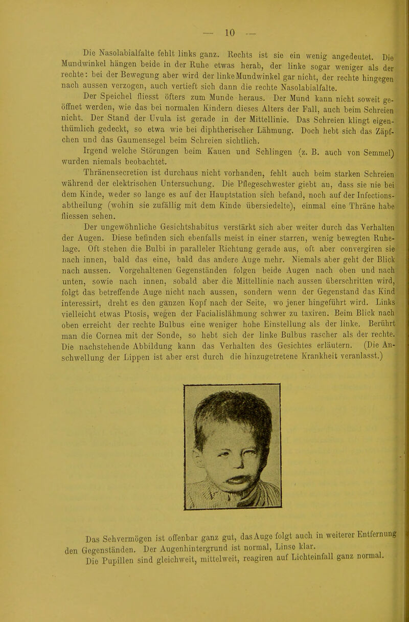 Die Nasolabialfalte fehlt links ganz. Rechts ist sie ein wenig angedeutet. Die Mundwinkel hängen beide in der Ruhe etwas herab, der linke sogar weniger als der rechte: bei der Bewegung aber wird der linke Mundwinkel gar nicht, der rechte hingegen nach aussen verzogen, auch vertieft sich dann die rechte Nasolabialfalte. Der Speichel fliesst öfters zum Munde heraus. Der Mund kann nicht soweit ge- öffnet werden, wie das bei normalen Kindern dieses Alters der Fall, auch beim Schreien nicht. Der Stand der Uvula ist gerade in der Mittellinie. Das Schreien klingt eigen- thümlich gedeckt, so etwa wie bei diphtherischer Lähmung. Doch hebt sich das Zäpf- chen und das Gaumensegel beim Schreien sichtlich. Irgend welche Störungen beim Kauen und Schlingen (z. B. auch von Semmel) wurden niemals beobachtet. Thränensecretion ist durchaus nicht vorhanden, fehlt auch beim starken Schreien während der elektrischen Untersuchung. Die Pflegeschwester giebt au, dass sie nie bei dem Kinde, weder so lange es auf dei Hauptstation sich befand, noch auf der Infections- abtheilung (wohin sie zufällig mit dem Kinde übersiedelte), einmal eine Thräne habe fliessen sehen. Der ungewöhnliche Gesichtshabitus verstärkt sich aber weiter durch das Verhalten der Augen. Diese befinden sich ebenfalls meist in einer starren, wenig bewegten Ruhe- lage. Oft stehen die Bulbi in paralleler Richtung gerade aus, oft aber convergiren sie nach innen, bald das eine, bald das andere Auge mehr. Niemals aber geht der Blick nach aussen. Vorgehaltenen Gegenständen folgen beide Augen nach oben und nach.' unten, sowie nach innen, sobald aber die Mittellinie nach aussen überschritten wird, folgt das betreffende Auge nicht nach aussen, sondern wenn der Gegenstand das Kind interessirt, dreht es den ganzen Kopf nach der Seite, wo jener hingeführt wird. Links vielleicht etwas Ptosis, wegen der Facialislähmung schwer zu taxiren. Beim Blick nach oben erreicht der rechte Bulbus eine weniger hohe Einstellung als der linke. Berührt man die Cornea mit der Sonde, so hebt sich der linke Bulbus rascher als der rechte. Die nachstehende Abbildung kann das Verhalten des Gesichtes erläutern. (Die An-' Schwellung der Lippen ist aber erst durch die hinzugetretene Krankheit veranlasst.) Das Sehvermögen ist offenbar ganz gut, das Auge folgt auch in weiterer Entfernung den Gegenständen. Der Augenhintergrund ist normal, Linse klar. Die Pupillen sind gleichweit, mittclweit, reagiren auf Lichteinfall ganz normal.