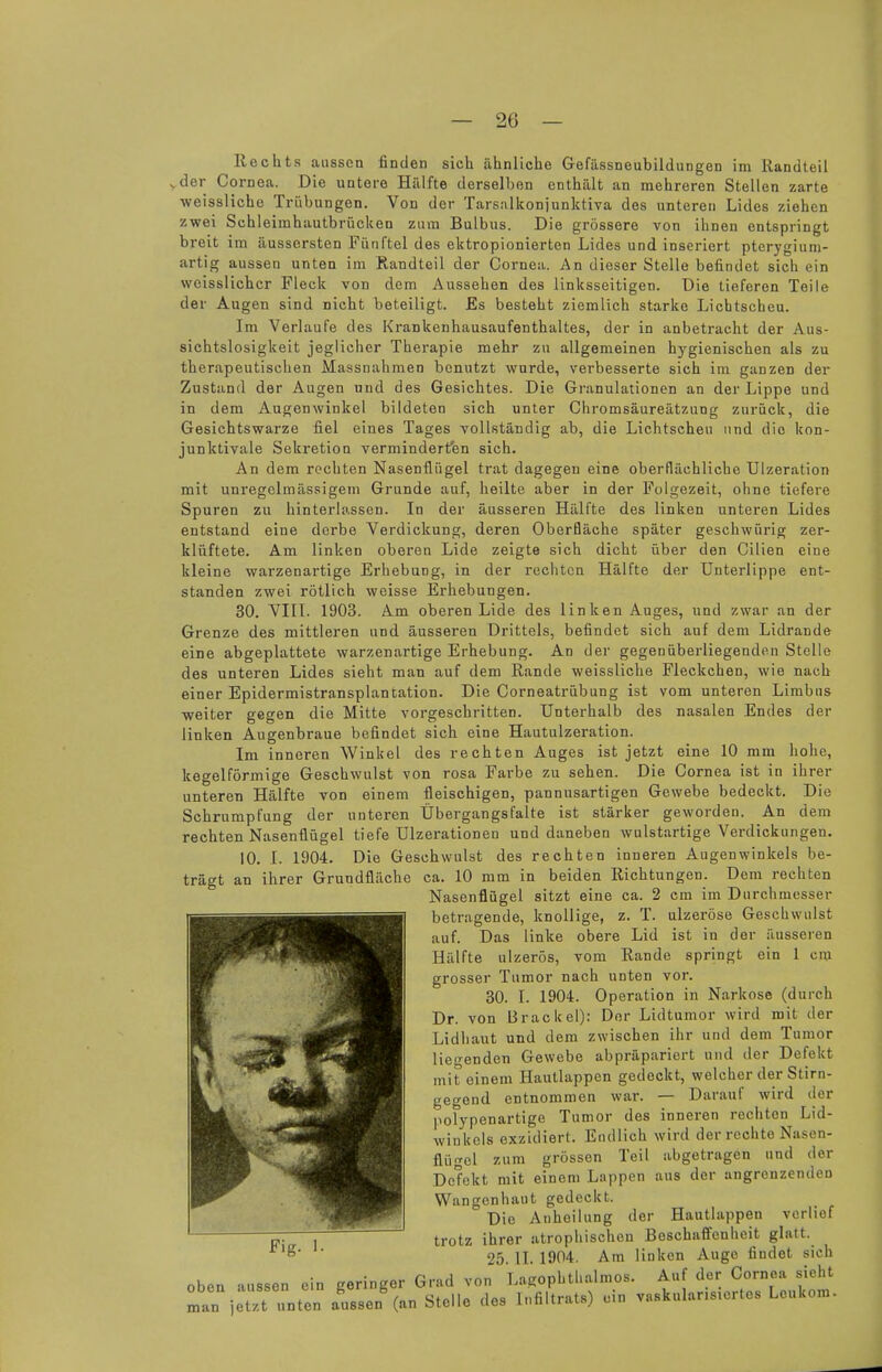 Rechts aussen finden sich ähnliche Gefässneubildungen im Randteil vder Cornea. Die untere Hälfte derselben enthält an mehreren Stellen zarte weissliche Trübungen. Von der Tarsalkonjunktiva des unteren Lides ziehen zwei Schleimhautbrücken zum Bulbus. Die grössere von ihnen entspringt breit im äussersten Fünftel des ektropionierten Lides und inseriert ptcrygium- artig aussen unteu im Randteil der Cornea. An dieser Stelle befindet sich ein weisslichcr Fleck von dem Aussehen des linksseitigen. Die tieferen Teile der Augen sind nicht beteiligt. Es besteht ziemlich starke Lichtscheu. Im Verlaufe des Krankenhausaufenthaltes, der in anbetracht der Aus- sichtslosigkeit jeglicher Therapie mehr zu allgemeinen hygienischen als zu therapeutischen Massnahmen benutzt wurde, verbesserte sich im ganzen der Zustand der Augen und des Gesichtes. Die Granulationen an der Lippe und in dem Augenwinkel bildeten sich unter Chromsäureätzung zurück, die Gesichtswarze fiel eines Tages vollständig ab, die Lichtscheu und die kon- junktivale Sekretion verminderten sich. An dem rechten Nasenflügel trat dagegen eine oberflächliche Ulzeration mit unregelmässigem Grunde auf, heilte aber in der Folgezeit, ohne tiefere Spuren zu hinterlassen. In der äusseren Hälfte des linken unteren Lides entstand eine derbe Verdickung, deren Oberfläche später geschwürig zer- klüftete. Am linken oberen Lide zeigte sich dicht über den Cilien eine kleine warzenartige Erhebung, in der rechten Hälfte der Unterlippe ent- standen zwei rötlich weisse Erhebungen. 30. VIII. 1903. Am oberen Lide des linken Auges, und zwar an der Grenze des mittleren und äusseren Drittels, befindet sich auf dem Lidrande eine abgeplattete warzenartige Erhebung. An der gegenüberliegenden Stelle des unteren Lides sieht man auf dem Rande weissliche Fleckchen, wie nach einer Epidermistransplancation. Die Corneatrübung ist vom unteren Limbns weiter gegen die Mitte vorgeschritten. Unterhalb des nasalen Endes der linken Augenbraue befindet sich eine Hautulzeration. Im inneren Winkel des rechten Auges ist jetzt eine 10 mm hohe, kegelförmige Geschwulst von rosa Farbe zu sehen. Die Cornea ist in ihrer unteren Hälfte von einem fleischigen, pannusartigen Gewebe bedeckt. Die Schrumpfung der unteren Übergangsfalte ist stärker geworden. An dem rechten Nasenflügel tiefe Ulzerationen und daneben wulstartige Verdickungen. 10. I. 1904. Die Geschwulst des rechten inneren Augenwinkels be- ihrer Grundfläche ca. 10 mm in beiden Richtungen. Dem rechten Nasenflügel sitzt eine ca. 2 cm im Durchmesser betragende, knollige, z. T. ulzeröse Geschwulst auf. Das linke obere Lid ist in der äusseren Hälfte ulzerös, vom Rande springt ein 1 cm grosser Tumor nach unten vor. 30. I. 1904. Operation in Narkose (durch Dr. von Brackel): Der Lidtumor wird mit der Lidhaut und dem zwischen ihr und dem Tumor liegenden Gewebe abpräpariert und der Defekt mit einem Hautlappen gedeckt, welcher der Stirn- gegend entnommen war. — Darauf wird der polypenartige Tumor des inneren rechten Lid- wiukels exzidiert. Endlich wird derreohte Nasen- flügcl zum grossen Teil abgetragen und der Defekt mit einem Lappen aus der angrenzenden Wangenhaut gedeckt. Die Anheilung der Hautlappen verlief trotz ihrer atrophischen Beschaffenheit glatt. 25 II. 1904. Am linken Auge findet sich oben aussen ein geringer Grad von Lagophthalmos. Auf der Cornea sieht man jeS unten aussen (an Stelle des Infiltrats) ein vaskuläres Leukom. trägt an
