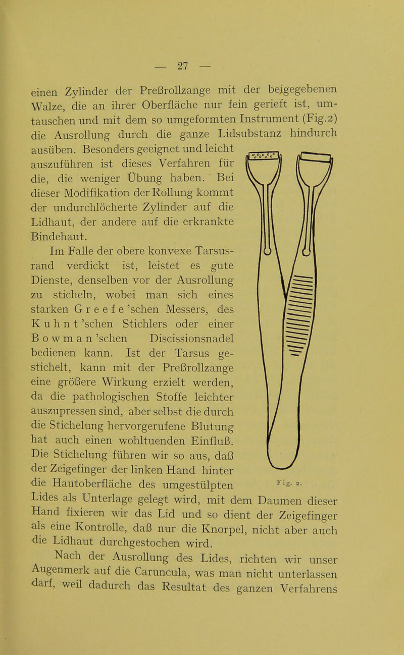 einen Zylinder der Preßrollzange mit der beigegebenen Walze, die an ihrer Oberfläche nur fein gerieft ist, um- tauschen und mit dem so umgeformten Instrument (Fig.2) die Ausrollung durch die ganze Lidsubstanz hindurch ausüben. Besonders geeignet und leicht auszuführen ist dieses Verfahren für die, die weniger Übung haben. Bei dieser Modifikation der Rollung kommt der undurchlöcherte Zylinder auf die Lidhaut, der andere auf die erkrankte Bindehaut. Im Falle der obere konvexe Tarsus- rand verdickt ist, leistet es gute Dienste, denselben vor der Ausrollung zu sticheln, wobei man sich eines starken G r e e f e 'sehen Messers, des K u h n t 'sehen Stichlers oder einer B o w m a n 'sehen Discissionsnadel bedienen kann. Ist der Tarsus ge- stichelt, kann mit der Preßrollzange eine größere Wirkung erzielt werden, da die pathologischen Stoffe leichter auszupressen sind, aber selbst die durch die Stichelung hervorgerufene Blutung hat auch einen wohltuenden Einfluß. Die Stichelung führen wir so aus, daß der Zeigefinger der linken Hand hinter die Hautoberfläche des umgestülpten Lides als Unterlage gelegt wird, mit dem Daumen dieser Hand fixieren wir das Lid und so dient der Zeigefinger als eine Kontrolle, daß nur die Knorpel, nicht aber auch die Lidhaut durchgestochen wird. Nach der Ausrollung des Lides, richten wir unser Augenmerk auf die Caruncula, was man nicht unterlassen darf, weil dadurch das Resultat des ganzen Verfahrens Fig. 2.