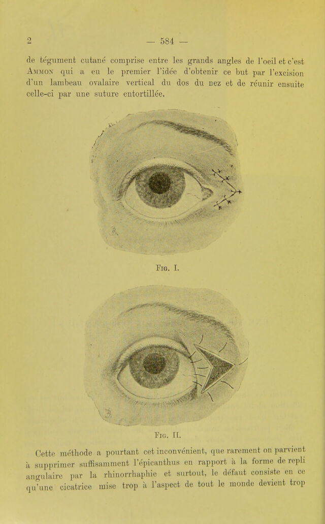 digitised image 2