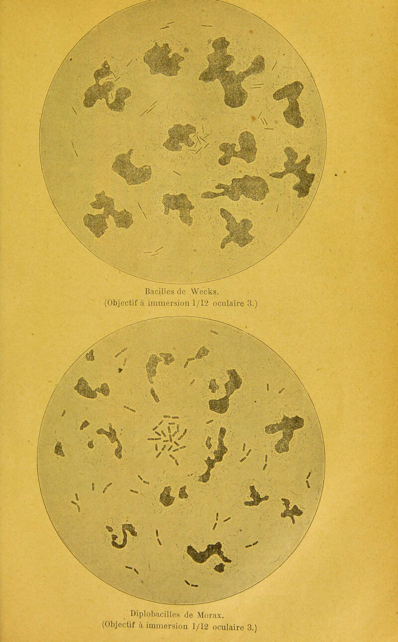 Bacilles de Wecks. (Objectif à immersioa 1/12 oculaire 3.) Diplob/icillcs de Morax. (Objectif à immersion 1/12 oculaire 3.)
