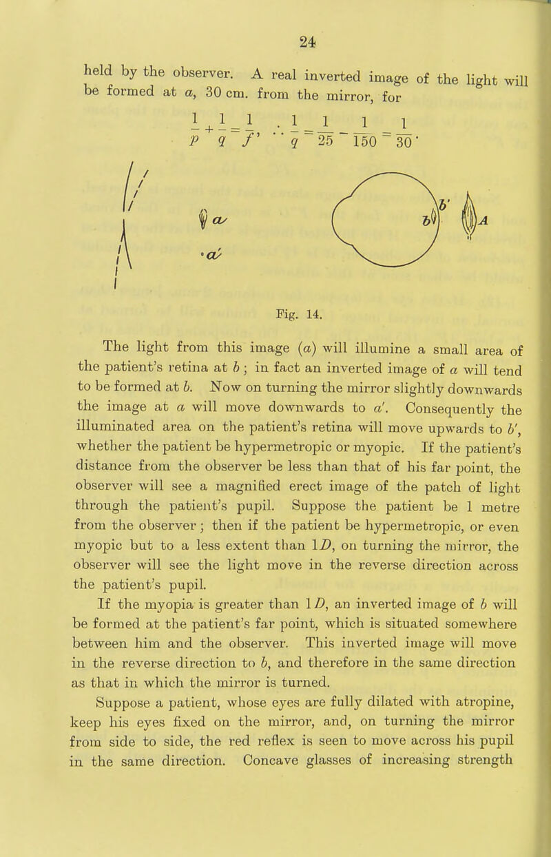held by the observer. A real inverted image of the light will be formed at a, 30 cm. from the mirror, for Fig. 14. The light from this image (a) will illumine a small area of the patient's retina at h ; in fact an inverted image of a will tend to be formed at b. Now on turning the mirror slightly downwards the image at a will move downwards to a'. Consequently the illuminated area on the patient's retina will move upwards to b', whether the patient be hypermetropic or myopic. If the patient's distance from the observer be less than that of his far point, the observer will see a magnified erect image of the patch of light through the patient's pupil. Suppose the patient be 1 metre from the observer; then if the patient be hypermetropic, or even myopic but to a less extent than ID, on turning the mirror, the observer will see the light move in the reverse direction across the patient's pupil. If the myopia is greater than 1D, an inverted image of b will be formed at the patient's far point, which is situated somewhere between him and the observer. This inverted image will move in the reverse direction to b, and therefore in the same direction as that in which the mirror is turned. Suppose a patient, whose eyes are fully dilated with atropine, keep his eyes fixed on the mirror, and, on turning the mirror from side to side, the red reflex is seen to move across his pupil in the same direction. Concave glasses of increasing strength