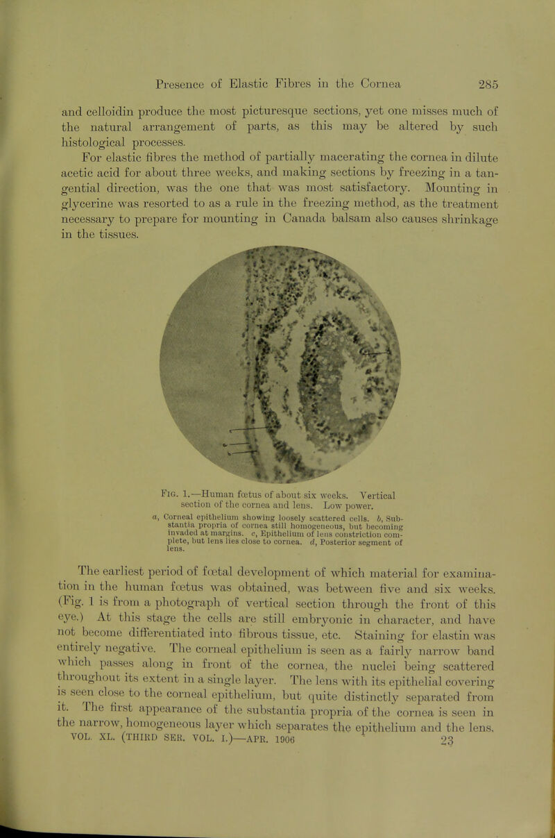 and celloidin produce the most picturesque sections, yet one misses much of the natural arrangement of parts, as this may be altered by such histological processes. For elastic fibres the method of partially macerating the cornea in dilute acetic acid for about three weeks, and making sections by freezing in a tan- gential direction, was the one that was most satisfactory. Mounting in glycerine was resorted to as a rule in the freezing method, as the treatment necessary to prepare for mounting in Canada balsam also causes shrinkage in the tissues. Fig. 1.—Human foetus of about six weeks. Vertical section of the cornea and lens. Low power. a, Corneal epithelium showing loosely scattered cells, b, Sub- stantia propria of cornea still homogeneous, but becoming invaded at margins, c, Epithelium of lens constriction com- plete, but lens lies close to cornea, d, Posterior segment of lens. The earliest period of foetal development of which material for examina- tion in the human foetus was obtained, was between five and six weeks. (Fig. 1 is from a photograph of vertical section through the front of this eye.) At this stage the cells arc still embryonic in character, and have not become differentiated into fibrous tissue, etc. Staining for elastin was entirely negative. The corneal epithelium is seen as a fairly narrow band which passes along in front of the cornea, the nuclei being scattered throughout its extent in a single layer. The lens with its epithelial covering is seen close to the corneal epithelium, but quite distinctly separated from it. The first appearance of the substantia propria of the'cornea, is seen in the narrow, homogeneous layer which separates the epithelium and the lens. VOL. XL. (THIRD SBR. VOL. I.)—APR. 1906 23