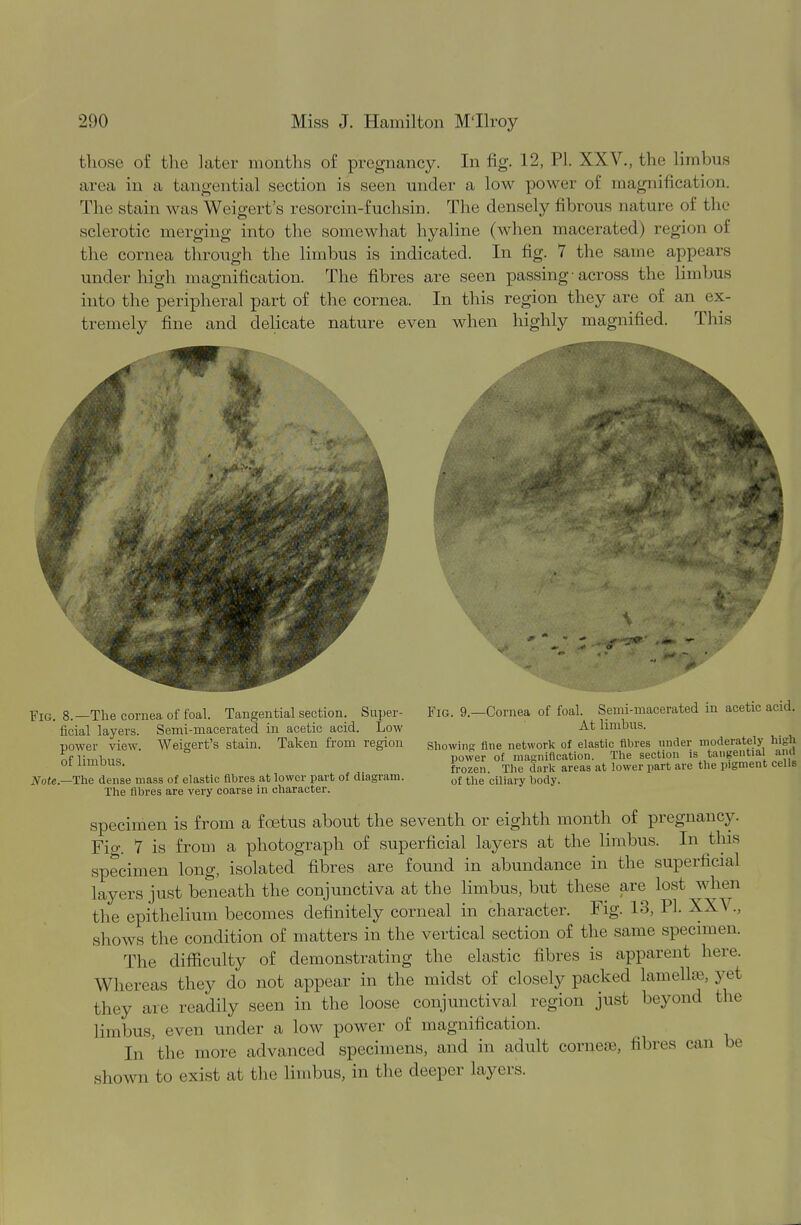 those of the later months of pregnancy. In fig. 12, PL XXV., the limbus area in a tangential section is seen under a low power of magnification. The stain was Weigert's resorcin-fuchsin. The densely fibrous nature of the sclerotic merging into the somewhat hyaline (when macerated) region of the cornea through the limbus is indicated. In fig. 7 the same appears under high magnification. The fibres are seen passing-across the limbus into the peripheral part of the cornea. In this region they are of an ex- tremely fine and delicate nature even when highly magnified. This A Fie. 8.—The cornea of foal. Tangential section. Super- ficial layers. Semi-macerated in acetic acid. Low power view. Weigert's stain. Taken from region of limbus. Note— The dense mass of elastic fibres at lower part of diagram. The fibres are very coarse in character. Fig. 9.—Cornea of foal. Semi-macerated in acetic acid. At limbus. Showing fine network of elastic fibres under moderately high power of magnification. The section is tangential and frozen. The dark areas at lower part are the pigment cells of the ciliary body. specimen is from a foetus about the seventh or eighth month of pregnancy. Fig. 1 is from a photograph of superficial layers at the limbus. In this specimen long, isolated fibres are found in abundance in the superficial layers just beneath the conjunctiva at the limbus, but these are lost when the epithelium becomes definitely corneal in character. Fig. 13, PI. XXA .. shows the condition of matters in the vertical section of the same specimen. The difficulty of demonstrating the elastic fibres is apparent here. Whereas they do not appear in the midst of closely packed lam el he, yet they are readily seen in the loose conjunctival region just beyond the limbus, « ven under a low power of magnification. In the more advanced specimens, and in adult cornea3, fibres can be shown to exist at the limbus, in the deeper layers.