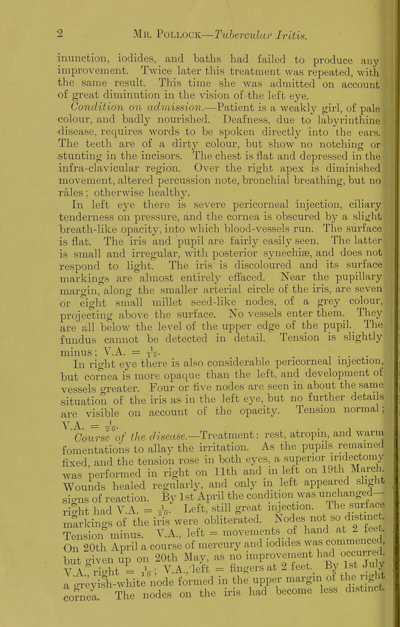 ■2 Mu. VoLLOCK—Tubercular Iritis. | inunction, iodides, and baths had failed to produce any improvement. Twice later this treatment was repeated, with the same result. This time she was admitted on account of great diminution in the vision of the left eye. Condition on admissiov.—Patient is a weakly girl, of pale colour, and badly nourished. Deafness, due to labyrinthine disease, requires words to be spoken directly into the ears. The teeth are of a dirty colour, but show no notching or stunting in the incisors. The chest is flat and depressed in the infra-clavicular region. Over the right apex is diminished movement, altered percussion note, bronchial breathing, but no rales; otherwise healthy. In left eye there is severe pericorneal injection, ciliary tenderness on pressure, and the cornea is obscured by a slitjht breath-like opacity, into which blood-vessels run. The surface is flat. The iris and pupil are fairly easily seen. The latter is small and irregular, with posterior synechias, and does not respond to light. The iris is discoloured and its surface markings are almost entirely effaced. Near the pupillary margin, along the smaller arterial circle of the iris, are seven or eight small millet seed-like nodes, of a grey colour, projecting above the surface. No vessels enter them. They are' all below the level of the upper edge of the pupil. The fundus cannot be detected in detail. Tension is slightly minus; V.A. = xV- ... In right eye there is also considerable pericorneal nijection, but coraea is more opaque than the left, and development of vessels o-reater. Four or five nodes are seen in about the sarne situation of the iris as in the left eye, but no further details are visible on account of the opacity. Tension normal; 'courseof the c/?sease.—Treatment: rest, atropin, and warni fomentations to allay the irritation. As the pupils remained fixed and the tension rose in both eyes, a superior iridectomy was performed in right on 11th and in left on 19th March Wounds healed regularly, and only m left appeared slight signs of reaction. By 1 st April the condition was unchanged- rig-ht had V.A. = ^. Left, still great iiyection. /he surface markings of the iris were obliterated. Nodes not ««/f^^^ - Tension minus. V.A., left = movements of hand at 2 teet. On 20th April a course of mercury and iodides was commenced, but given up on 20th May, as no improvement bad oecuri<.l V A - - VA 'left = fingers at 2 feet. Hy ist Juiy r.ty stwhit nodelovmed in the uppor margin of the ngM coS The nodes on the iris had become less d.stmet.