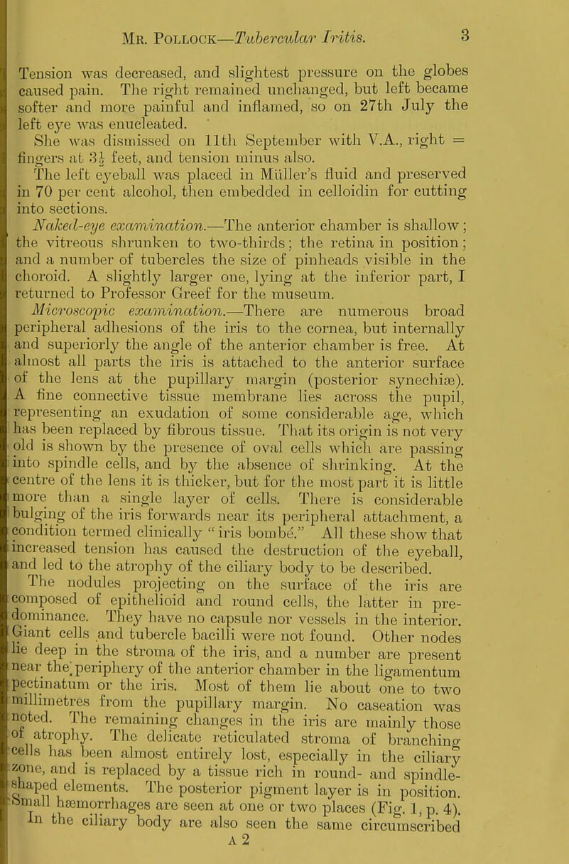 Tension was decreased, and slightest pressure on the globes caused pain. Tlie right remained unchanged, but left became softer and more painful and inflamed, so on 27th July the left eye was enucleated. She was dismissed on 11th September with V.A., right = fingers at 3| feet, and tension minus also. The left ej^eball was placed in Mliller's fluid and preserved in 70 per cent alcohol, then embedded in celloidin for cutting into sections. Naked-eye examination.—The anterior chamber is shallow; the vitreous shrunken to two-thirds; the retina in position; and a number of tubercles the size of pinheads visible in the choroid. A slightly larger one, lying at the inferior part, I returned to Professor Greef for the museum. Microscopic examination.—There are numerous broad peripheral adhesions of the iris to the cornea, but internally and superiorly the angle of the anterior chamber is free. At almost all parts the iris is attached to the anterior surface of the lens at the pupillary margin (posterior synechise). A fine connective tissue membrane lies across the pupil, representing an exudation of some considerable age, which has been replaced by fibrous tissue. That its origin is not very old is shown by the presence of oval cells which are passing into spindle cells, and by the absence of shrinking. At the centre of the lens it is thicker, but for the most part it is little more than a single layer of cells. There is considerable bulging of the iris forwards near its peripheral attachment, a condition termed clinically  iris bombe. All these show that increased tension has caused the destruction of the eyeball, and led to the atrophy of the ciliary body to be described. The nodules projecting on the surface of the iris are composed of epithelioid and round cells, the latter in pre- dommance. They have no capsule nor vessels in the interior. Giant cells and tubercle bacilli were not found. Other nodes lie deep in the stroma of the iris, and a number are present near the; periphery of the anterior chamber in the ligamentum pectinatum or the iris. Most of them lie about one to two milhmetres from the pupillary margin. No caseation was noted. The remaining changes in the iris are mainly those ot atrophy. The delicate reticulated stroma of branching cells has been almost entirely lost, especially in the ciliary zone, and is replaced by a tissue rich in round- and spindle- shaped elements. The posterior pigment layer is in position. Ismail haemorrhages are seen at one or two places (Fig. 1, p. 4). In the ciliary body are also seen the same circumscribed A 2