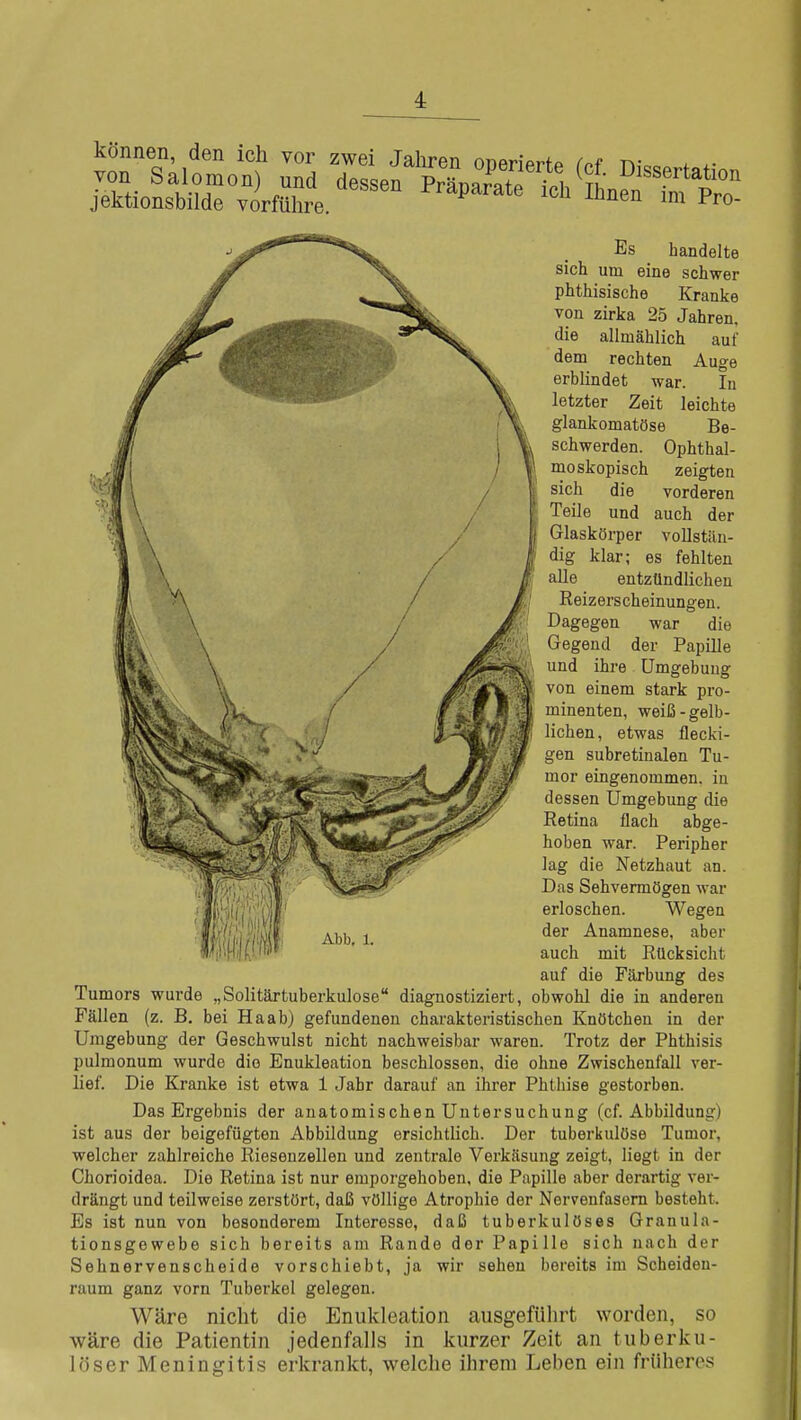 können, den ich vor zwei Jahren oneriprfp fnf n;o , Es handelte sich um eine schwer phthisische Kranke von zirka 25 Jahren, die allmählich auf dem rechten Auge erblindet war. In letzter Zeit leichte glankomatöse Be- schwerden. Ophthal- moskopisch zeigten sich die vorderen Teile und auch der Glaskörper vollstiüi- dig klar; es fehlten alle entzündlichen Reizerscheinungen. Dagegen war die Gegend der Papille und ihre Umgebung von einem stark pro- minenten, weiß-gelb- lichen, etwas flecki- gen subretinalen Tu- mor eingenommen, in dessen Umgebung die Retina flach abge- hoben war. Peripher lag die Netzhaut an. Das Sehvermögen war erloschen. Wegen der Anamnese, aber auch mit Rücksicht auf die Färbung des Tumors wurde „Solitärtuberkulose diagnostiziert, obwohl die in anderen Fällen (z. B. bei Ha ab) gefundenen charakteristischen Knötchen in der Umgebung der Geschwulst nicht nachweisbar waren. Trotz der Phthisis pulmonum wurde die Enukleation beschlossen, die ohne Zwischenfall ver- lief. Die Kranke ist etwa 1 Jahr darauf an ihrer Phthise gestorben. Das Ergebnis der anatomischen Untersuchung (cf. Abbildung) ist aus der beigefügten Abbildung ersichtlich. Der tuberkulöse Tumor, welcher zahlreiche Riesenzellen und zentrale Verkäsung zeigt, liegt in der Chorioidea. Die Retina ist nur emporgehoben, die Papille aber derartig ver- drängt und teilweise zerstört, daß völlige Atrophie der Nervenfasern besteht. Es ist nun von besonderem Interesse, daß tuberkulöses Granula- tionsgewebe sich bereits am Rande der Papille sich nach der Sehnervenscheide vorschiebt, ja wir sehen bereits im Scheiden- raum ganz vorn Tuberkel gelegen. Wäre nicht die Enukleation ausgeführt worden, so wäre die Patientin jedenfalls in kurzer Zeit an tuberku- löser Meningitis erkrankt, welche ihrem Leben ein früheres