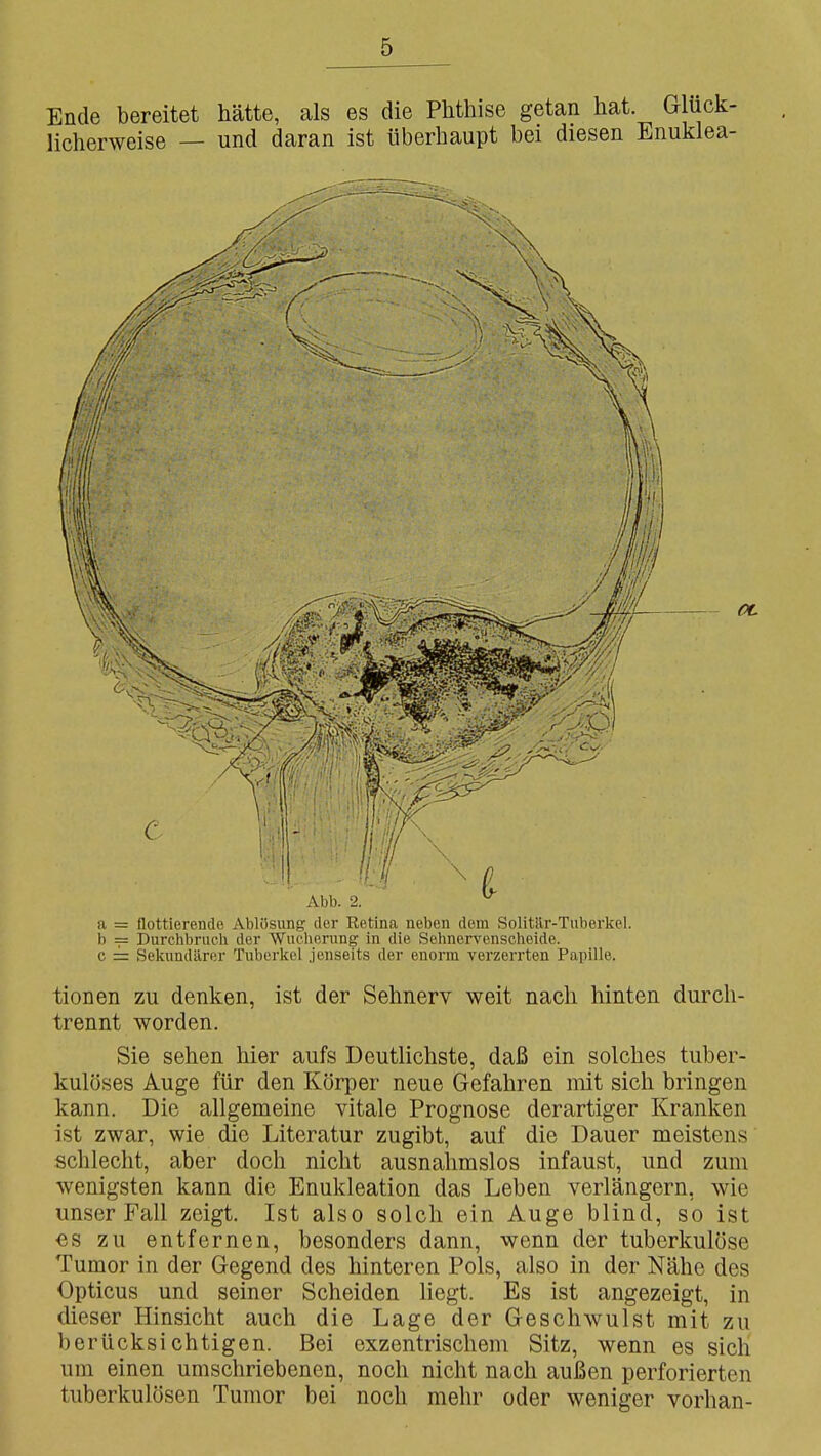 Ende bereitet hätte, als es die Phthise getan hat. Glück- licherweise — und daran ist überhaupt bei diesen Enuklea- tionen zu denken, ist der Sehnerv weit nach hinten durch- trennt worden. Sie sehen hier aufs Deutlichste, daß ein solches tuber- kulöses Auge für den Körper neue Gefahren niit sich bringen kann. Die allgemeine vitale Prognose derartiger Kranken ist zwar, wie die Literatur zugibt, auf die Dauer meistens schlecht, aber doch nicht ausnahmslos infaust, und zum wenigsten kann die Enukleation das Leben verlängern, wie unser Fall zeigt. Ist also solch ein Auge blind, so ist €s zu entfernen, besonders dann, wenn der tuberkulöse Tumor in der Gegend des hinteren Pols, also in der Nähe des Opticus und seiner Scheiden liegt. Es ist angezeigt, in dieser Hinsicht auch die Lage der Geschwulst mit zu berücksichtigen. Bei exzentrischem Sitz, wenn es sich um einen umschriebenen, noch nicht nach außen perforierten tuberkulösen Tumor bei noch mehr oder weniger vorhan-