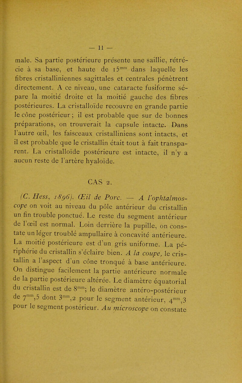 maie. Sa partie postérieure présente une saillie, rétré- cie à sa base, et haute de iS'' dans laquelle les fibres cristalliniennes sagittales et centrales pénètrent directement. A ce niveau, une cataracte fusiforme sé- pare la moitié droite et la moitié gauche des fibres postérieures. La cristalloïde recouvre en grande partie le cône postérieur ; il est probable que sur de bonnes préparations, on trouverait la capsule intacte. Dans l'autre œil, les faisceaux cristalliniens sont intacts, et il est probable que le cristallin était tout à fait transpa- rent. La cristalloïde postérieure est intacte, il n'y a aucun reste de Tartère hyaloïde. CAS 2. (C.Hess, 1896). Œil de Porc. — A l'ophtalmos- cope on voit au niveau du pôle antérieur du cristallin un fin trouble ponctué. Le reste du segment antérieur de rœil est normal. Loin derrière la pupille, on cons- tate un léger troublé ampullaire à concavité antérieure. La moitié postérieure est d'un gris uniforme. La pé- riphérie du cristallin s'éclaire bien. A la coupe, le cris- tallin a l'aspect d'un cône tronqué à base antérieure. On distingue facilement la partie antérieure normale de la partie postérieure altérée. Le diamètre équatorial du cristallin est de 8''; le diamètre antéro-postérieur de y'',5 dont 3'',2 pour le segment antérieur, 4''^,3 pour le segment postérieur. Au microscope on constate