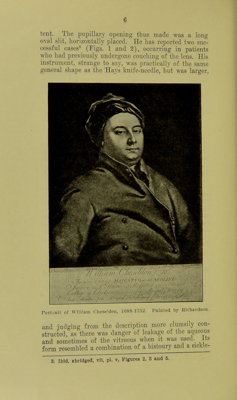 tent. The pupillary opening thus made was a long oval slit, horizontally placed. He has reported two suc- cessful cases^ (T'igs. 1 and 2), occurring in patients who had previously undergone couching of the lens. His instrument, strange to say, was practically of the same general shape as the Hays knife-needle, but was larger, rort.ait of William Cheseldeu, 1088-175:^. Painted by Rlchai-dson. and iudging from the description more clumsily con- structed, as there was danger of leakage of the aqueous and sometimes of the vitreous when it was used, its form resembled a combination of a bistoury and a sickle- 3. Ibid, abridged, vU, pi. v. Figures 2, 3 and