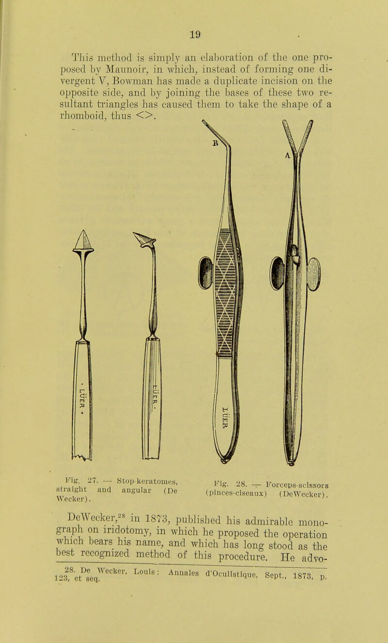 'J'liio motliod is simpl}^ an elaboration of tlie one pro- posed by Maunoir, in which, instead of forming one di- vergent V, Bowman has made a duplicate incision on the opposite side, and b}'^ joining the bases of these two re- sultant ti-iangles has caused them to take the shape of a rhomboid, thus <>. Pi 1^ KiK. -7. — Stoi) keratomes, straiKht aud angular (De Wecker). Kig. 28. Forceps-scissors (plnces-ciseaux) (DeWcckcr). DeWecker,2« m 1873, published his admirable mono- graph on indotomy, in which he proposed the operation which bears his name, and which has long stood as the best recognized method of this procedure. He advo- 12l,^ct°8cq!''''' • d'Oculistique. Sept.. 1873,T