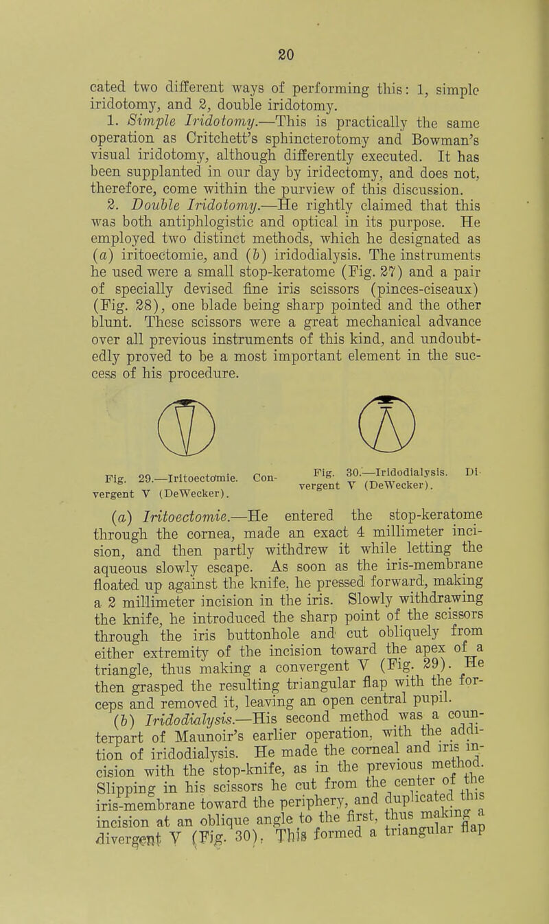 cated two different ways of performing this: 1, simple iridotomy, and 2, double iridotomy. 1. Simple Iridotoimj.—This is practically the same operation as Critchett's sphincterotomy and Bowman's visual iridotomy, although differently executed. It has been supplanted in our day by iridectomy, and does not, therefore, come within the purview of this discussion. 2. Double Iridotomy.—He rightly claimed that this was both antiphlogistic and optical in its purpose. He employed two distinct methods, which he designated as (a) iritoectomie, and (6) iridodialysis. The instruments he used were a small stop-keratome (Fig. 27) and a pair of specially devised fine iris scissors (pinces-ciseaux) (Fig. 28), one blade being sharp pointed and the other blunt. These scissors were a great mechanical advance over all previous instruments of this kind, and undoubt- edly proved to be a most important element in tlie suc- cess of his procedure. Fig. 29.-Iritoectolnie. Con- , , ^ vergent V (DeWecker). vergent V (DeWecker). (a) Iritoectomie.—He entered the stop-keratome through the cornea, made an exact 4 millimeter inci- sion, and then partly withdrew it while letting the aqueous slowly escape. As soon as the iris-membrane floated up against the knife, he pressed forward, making a 2 millimeter incision in the iris. Slowly withdrawing the knife, he introduced the sharp point of the scissors through the iris buttonhole and cut obliquely from either extremity of the incision toward the apex of a triangle, thus making a convergent V (Fig. 29). He then grasped the resulting triangular flap with the for- ceps and removed it, leaving an open central pupil. (&) Iridodialysis.—ms second method was a coun- terpart of Maunoir's earlier operation, with the addi- tion of iridodialysis. He made the corneal and ins in- cision with the stop-knife, as in the previous method Slipping in his scissors he cut from ^^^'^^'^^^^^^ iris-membrane toward the periphery, and cl^ipl^c^^^.'^J^;'^ incision at an oblique angle to the first, «Yr^.^,tr flaS divergent V (Fi^. 30). This formed a triangular flap