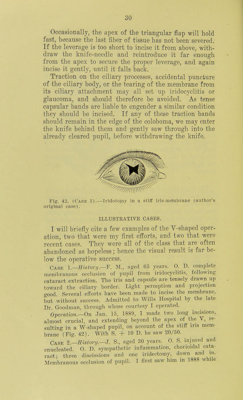 Occasionally, the apex of the triangular flap will hold fast, because the last fiber of tissue has not been severed. If the leverage is too short to incise it from above, with- draw the knife-needle and reintroduce it far enough from the apex to secure the proper leverage, and again incise it gently, until it falls back. Traction on the ciliary processes, accidental puncture of the ciliary body, or the tearing of the membrane from its ciliary attachment may all set up iridocyclitis or glaucoma, and should therefore be avoided. As tense capsular bands are liable to engender a similar condition they should be incised. If any of these traction bands should remain in the edge of the coloboma, we may enter the knife behind them and gently saw through into the already cleared pupil, before withdrawing the Imife. Fig. 42, (Case 1).—Iridotomy in a stiff iris-membrane (author's original case). ILLUSTRATIVE CASES. I will briefly cite a few examples of the V-shaped oper- ation, two that were my first efforts, and two that were recent cases. They were all of the class that are often abandoned as hopeless; hence the visual result is far be- low the operative success. Case l.—Hisiori/.—F. M., aged 65 j^ears. 0. D. complete membranous occlusion of pupil from iridocyclitis, following cataract extraction. The iris and capsule are tensely drawn up toward the ciliary border. Light perception and projection good Several efforts have been made to incise the membrane, but without success. Admitted to Wills Hospital by the late Dr. Goodman, through whose courtesy I operated. Operation.—On Jan. 15, 1889, I made two long incisions, almost crucial, and extending beyond the apex of the V, re- sulting in a W-shaped pupil, on account of the stiff ins mem- brane (Fig. 42). With S. + 10 D. he saw 20/50. CASE 2.-nistory.-J. S., aged 30 years. 0. S. injured and enucleated. 0. D. sympathetic inflammation, chorioidal cata- ract- three discissions and one iridectomy, down and in. Membranous occlusion of pupil. I first saw him in 1888 while