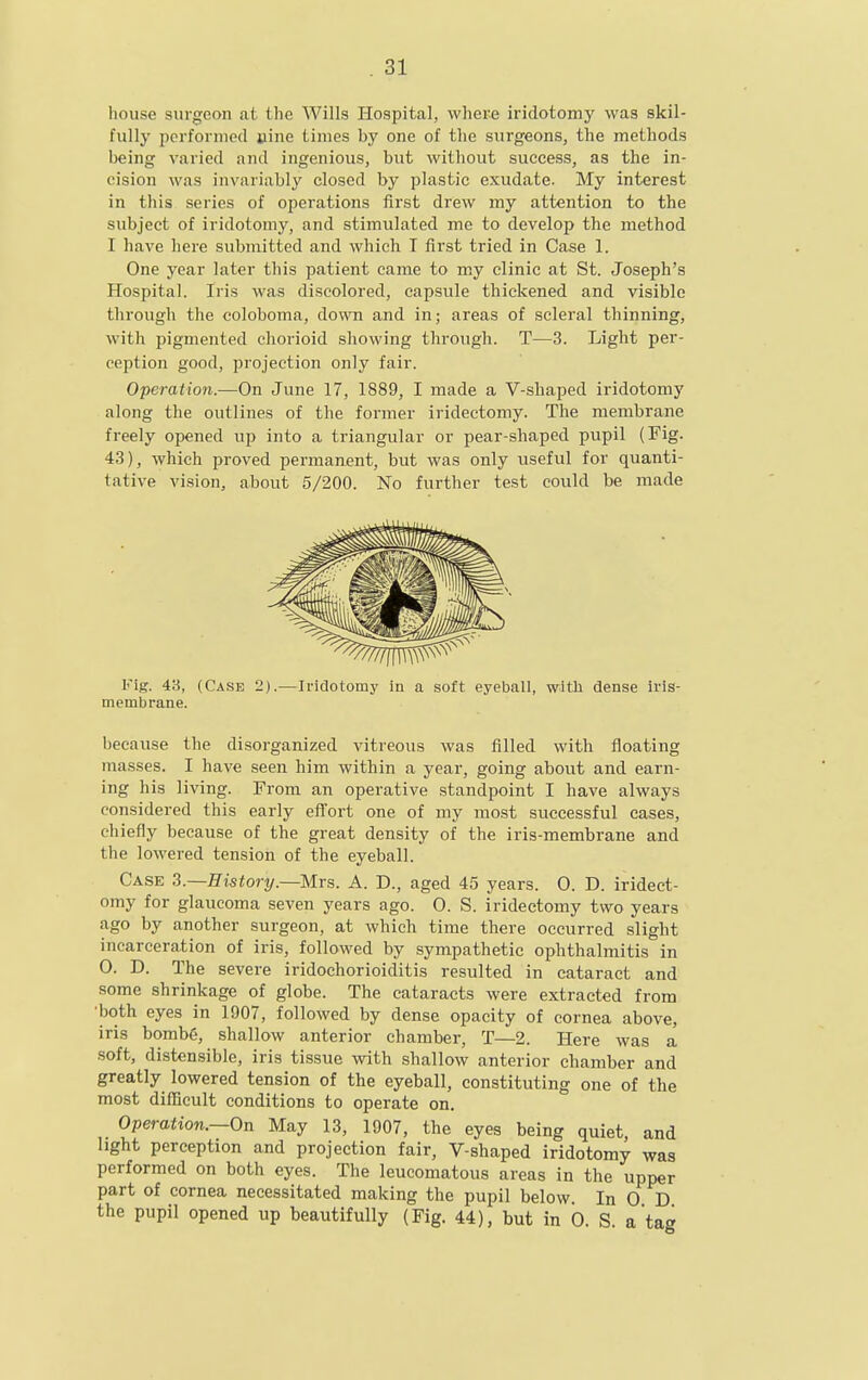 house surgeon at the Wills Hospital, where iridotomj' was skil- fully performed »ine times by one of the surgeons, the methods being varied and ingenious, but without success, as the in- cision was invariably closed by plastic exudate. My interest in this series of operations first drew my attention to the subject of iridotomy, and stimulated me to develop the method I have here submitted and which I first tried in Case 1. One year later this patient came to my clinic at St. Joseph's Hospital. Ii-is was discolored, capsule thickened and visible through the coloboma, down and in; areas of scleral thinning, with pigmented chorioid showing through. T—3. Light per- ception good, projection only fair. Operaiion.—On June 17, 1889, I made a V-shaped iridotomy along the outlines of the former iridectomy. The membrane freely opened up into a triangular or pear-shaped pupil (Fig. 43), which proved permanent, but was only useful for quanti- tative vision, about 5/200. No further test could be made Fig. 43, (Case 2).—Iridotomy in a soft eyeball, witJi dense iris- membrane. because the disorganized vitreous was filled with floating masses. I have seen him within a year, going about and earn- ing his living. From an operative standpoint I have always considered this early effort one of my most successful cases, chiefly because of the great density of the iris-membrane and the lowered tension of the eyeball. Case 3.—History.—Mrs. A. D., aged 45 years. 0. D. iridect- omy for glaucoma seven years ago. 0. S. iridectomy two years ago by another surgeon, at which time there occurred slight incarceration of iris, followed by sympathetic ophthalmitis in 0. D. The severe iridochorioiditis resulted in cataract and some shrinkage of globe. The cataracts were extracted from both eyes in 1907, followed by dense opacity of cornea above, iris bomb6, shallow anterior chamber, T—2. Here was a soft, distensible, iris tissue with shallow anterior chamber and greatly lowered tension of the eyeball, constituting one of the most difficult conditions to operate on. Operation.—On May 13, 1907, the eyes being quiet, and light perception and projection fair, V-shaped iridotomy was performed on both eyes. The Icucomatous areas in the upper part of cornea necessitated making the pupil below. In 0 D the pupil opened up beautifully (Fig. 44), but in 0. S a tag
