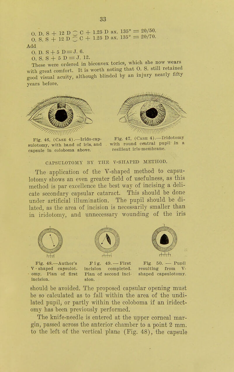 0. D 0. S. Add 0. D, 0. S S + 12 D - C + 1.25 D ax. 135° = 20/50. S + 12 D C C + 1.25 D ax. 135° = 20/70. S4-5 D = J. 6. ... ^. S + 5 D = J. 12. These were ordered in biconvex tories, which she now wears with great comfort. It is worth noting that 0. S. still retained good visual acuity, although blinded by an injury nearly fifty years before. Fig. 46, (Case 4).—Irido-cap- sulotomy, witli band of iris, and capsule in coloboma above. Fig. 47, (Case 4).—I'ridotomy with round central pupil in a resilient iris-membrane. CAPSULOTOMY BY THE 7-SHAPED METHOD. The application of the V-shaped method to capsu- lotomy shows an even greater field of usefulness, as this method is par excellence the best way of incising a deli- cate secondary capsular cataract. This should be done under artificial illumination. The pupil should be di- lated, as the area of incision is necessarily smaller than in iridotomy, and unnecessary wounding of the iris Fig. 48.—Author's V - shaped capsulot- omy. Plan of first incision. F i g. 49. — First incision completed. Plan of second inci- sion. Fig 50. — Pupil resulting from V- shaped capsulotomy. should be avoided. The proposed capsular opening must be so calculated as to fall within the area of the undi- lated pupil, or partly wiihin the coloboma if an iridect- omy has been previously performed. The knife-needle is entered at the upper corneal mar- gin, passed across the anterior chamber to a point 2 mm. to the left of the vertical plane (Fig. 48), the capsule