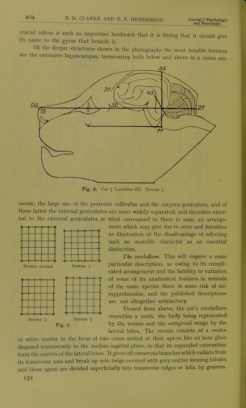 und Neurologic. crucial sulcus is such an important landmark that it is fitting that it should give its name to the gyrus that bounds it. Of the deeper structures shown in the photographs the most notable features are the extensive hippocampus, terminating both below and above in a cornu am- Fig. 6. Cat S Lamellae III. Screen 5. Screen normal Screen 2 monis; the large size of the posterior colliculus and the corpora geniculata, and of these latter the internal geniculates are more widely separated, and therefore exter- nal to the external geniculates or what correspond to them in man, an arrange- ment which may give rise to error and furnishes an illustration of the disadvantage of selecting such an unstable character as an essential distinction. The cerebellum. This will require a more particular description, as owing to its compli- cated arrangement and the liability to variation of some of its anatomical features in animals of the same species there is some risk of mi- sapprehension, and the published descriptions are not altogether satisfactory. Viewed from above, the cat's cerebellum resembles a moth, the body being represented by the vermis and the outspread wings by the lateral lobes. The vermis consists of a centre of white matter in the form of two cones united at their apices like an hour glass disposed transversely to the median sagittal plane, so that its expanded extremities form the centres of the lateral lobes. It gives off numerous branches which radiate from its transverse axis and break up into twigs covered with grey matter forming lobules and these again are divided superficially into transverse ridges or folia by grooves. 132 Screen 3 Screen 5 Fig. 7-