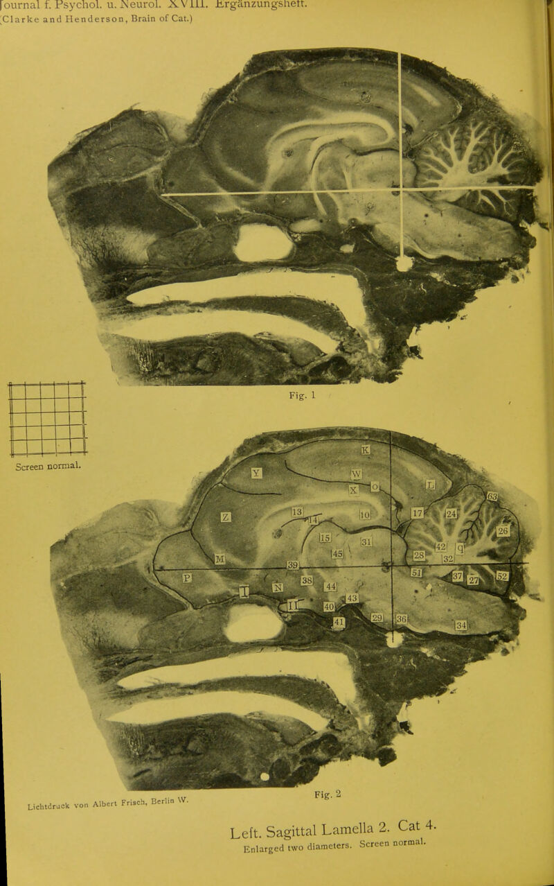 journal f. Psychol, u. Neurol. XVill. Jirganzungsnett. r