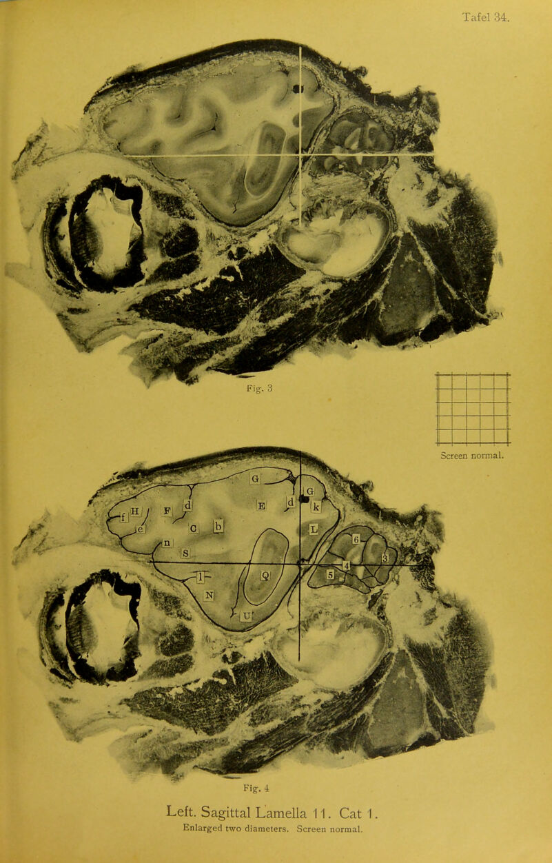 Left. Sagittal Lamella 11. Cat 1.