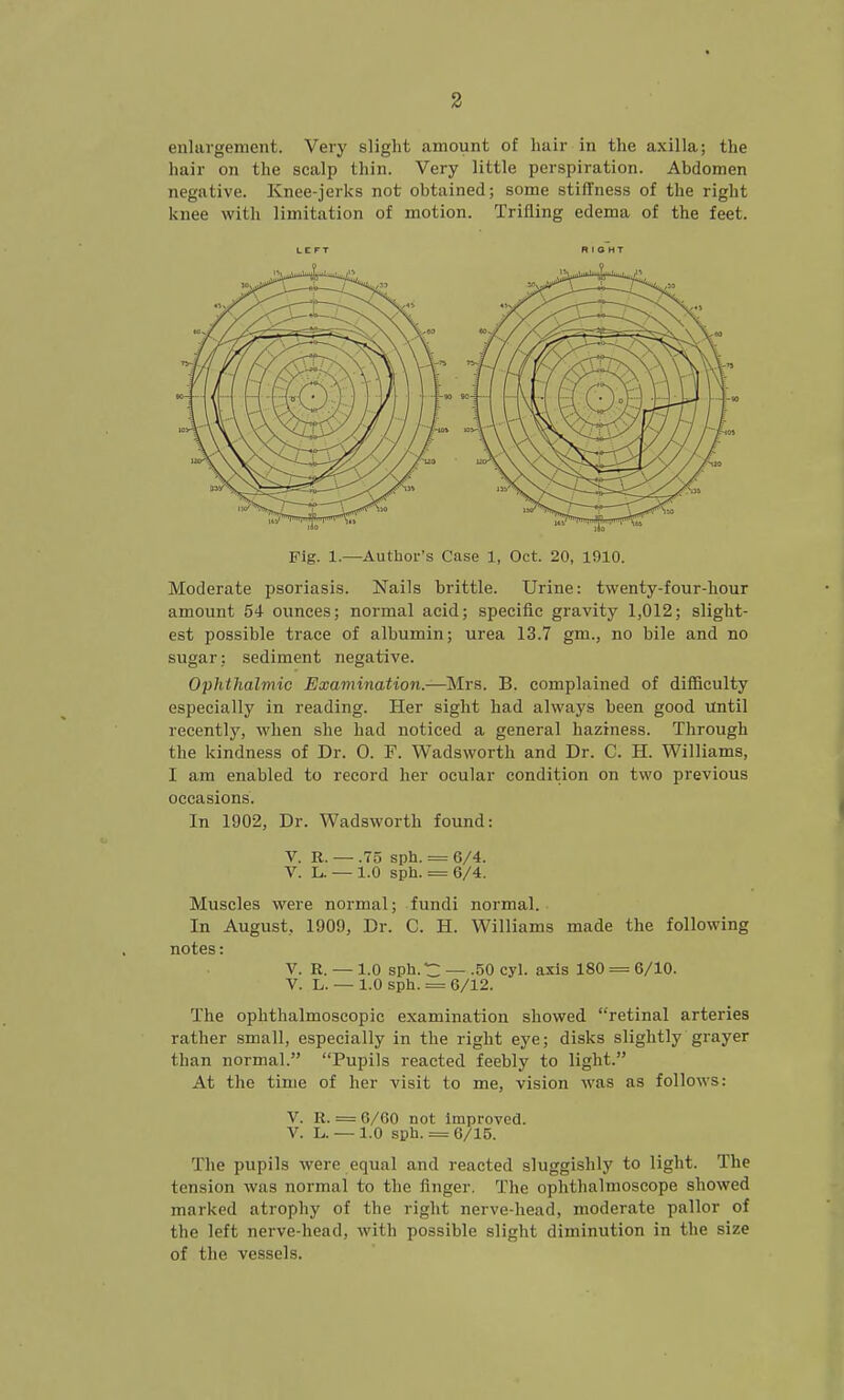 enlargement. Very slight amount of hair in the axilla; the hair on the scalp thin. Very little perspiration. Abdomen negative. Knee-jerks not obtained; some stiffness of the right knee with limitation of motion. Trifling edema of the feet. LEFT RIGHT Fig. 1.—Author's Case 1, Oct. 20, 1910. Moderate psoriasis. Nails brittle. Urine: twenty-four-hour amount 54 ounces; normal acid; specific gravity 1,012; slight- est possible trace of albumin; urea 13.7 gm., no bile and no sugar: sediment negative. Ophthalmic Examination.—Mrs. B. complained of difficulty especially in reading. Her sight had always been good until recently, when she had noticed a general haziness. Through the kindness of Dr. 0. F. Wadsworth and Dr. C. H. Williams, I am enabled to record her ocular condition on two previous occasions. In 1902, Dr. Wadsworth found: V. R. — .75 sph. = 6/4. V. L. — 1.0 sph. = 6/4. Muscles were normal; fundi normal. In August, 1909, Dr. C. H. Williams made the following notes: V. R. — 1.0 sph. t: — .50 cyl. axis 180 = 6/10. V. L. — 1.0 sph. = 6/12. The ophthalmoscopic examination showed retinal arteries rather small, especially in the right eye; disks slightly grayer than normal. Pupils reacted feebly to light. At the time of her visit to me, vision was as follows: V. R. = 6/60 not improved. V. L. — 1.0 sph. = 6/15. The pupils were equal and reacted sluggishly to light. The tension was normal to the finger, The ophthalmoscope showed marked atrophy of the right nerve-head, moderate pallor of the left nerve-head, with possible slight diminution in the size of the vessels.