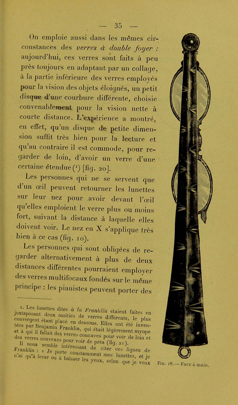 On emploie aussi dans les mêmes cir- constances des verres à double foyer : aujourd'hui, ces verres sont faits à peu près toujours en adaptant par un collage, à la partie intérieure des verres employés pour la vision des objets éloignés, un petit disque d'une courbure différente, choisie convenablement pour la vision nette à courte distance. L'expérience a montré, en effet, qu'un disque de petite dimen- sion suffit très bien pour la lecture et qu'au contraire il est commode, pour re- garder de loin, d'avoir un verre d'une certaine étendue (') [fîg. 20J. Les personnes qui ne se servent que d'un œil peuvent retourner les lunettes sur leur nez pour avoir devant l'œil qu'elles emploient le verre plus ou moins fort, suivant la distance à laquelle elles doivent voir. Le nez en X s'applique très bien à ce cas (fîg. 10). Les personnes qui sont obligées de re- garder alternativement à plus de deux distances différentes pourraient employer des verres multifocaux fondés sur le même principe : les pianistes peuvent porter des \nl:J:Z^TT^ « ^'•««/'•^''^ étaient faites en .)uxlapo.sant deux moitiés de verres diiréron.c i i converqent étant niar.,; „ i ^^^ aiuerents, le plus fées parneniJmi^ Pn Tv ^^'^}'- ^Ues ont été inïen- et à ui il f:;rauir;et:;J';'-' légèrement myope des verres convexes .''^'^^'^^ PO» ^O' de loin et  nous semriE;::'7^'i^'«-^'> Franklin : „ Je porte con:^ ' ^'■^«^s de n'ai au-àlevero^ti: 7;,^;^^^^^^^^ et je '^s yeux, selon que je veux Fig.