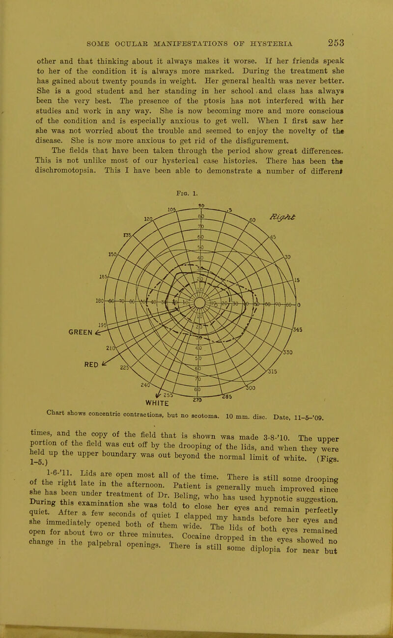 other and that thinking about it always makes it worse. If her friends speak to her of the condition it is always more marked. During the treatment she has gained about twenty pounds in weight. Her general health was never better. She is a good student and her standing in her school. and class has always been the very best. The presence of the ptosis has not interfered with her studies and work in any way. She is now becoming more and more conscious of the condition and is especially anxious to get well. When I first saw her she was not worried about the trouble and seemed to enjoy the novelty of th« disease. She is now more anxious to get rid of the disfigurement. The fields that have been taken through the period show great diflferenees. This is not unlike most of our hysterical case histories. There has been the diachromotopsia. This I have been able to demonstrate a number of differen* Fig. 1. GREEN RED 255 WHITE 270 Chart shows concentric contractions, but no scotoma. 10 mm. disc. Date, ll-6-'09. times, and the copy of the field that is shown was made 3-8-'10. The upper portion of the field was cut off by the drooping of the lids, and when they were heM up the upper boundary was out beyond the normal limit of white. (Figs. of °P^° °f the time. There is still some drooping of the right late in the afternoon. Patient is generally much improved e^nJ she has been under treatment of Dr. Beling, who%as used hypnotic su 'Lt on she immediately openrbt^ofTem wMrThTlMstf borev':^ '''' -^1 open for about two or three mimitp-, Pn.o 7 , remained