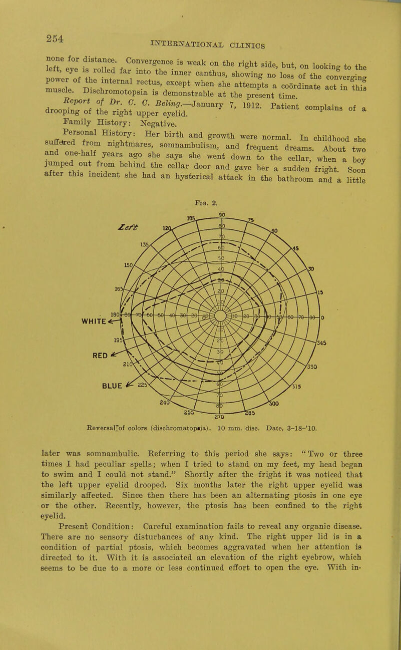 INTERNATIONAL, CLINICS left, eye IS ro led far mto the mner canthus, showing no loss of the converirin^ power of the internal rectus, except when she attempts a co5rd nate actTn Tw! muscle. Dischromotopsia is demonstrable at the present time droopinTof tt''--M' ^^^^^-r^—y 7, 1912. Patient complains of a arooping of the right upper eyelid. Family History: Negative. suffJeTTrf ^''17'- ^^'^ 1° ^^ildhood she n I t ^^ghtmares, somnambulism, and frequent dreams. About two and one-half years ago she says she went down to the cellar, when a boy jumped out from behind the cellar door and gave her a sudden fright. Soon after this incident she had an hysterical attack in the bathroom a^d a little Fio. 2. RED BLUE 270 ReversalXof colors (disohromatopiia). 10 mm. disc. Date, 3-18-'10. later was somnambulic. Referring to this period she says: Two or three times I had peculiar spells; when I tried to stand on my feet, my head began to swim and I could not stand. Shortly after the fright it was noticed that the left upper eyelid drooped. Six months later the right upper eyelid was similarly affected. Since then there has been an alternating ptosis in one eye or the other. Recently, however, the ptosis has been confined to the right eyelid. Present Condition: Careful examination fails to reveal any organic disease. There are no sensory disturbances of any kind. The right upper lid is in a condition of partial ptosis, which becomes aggravated when her attention is directed to it. With it is associated an elevation of the right eyebrow, which seems to be due to a more or less continued effort to open the eye. With in-
