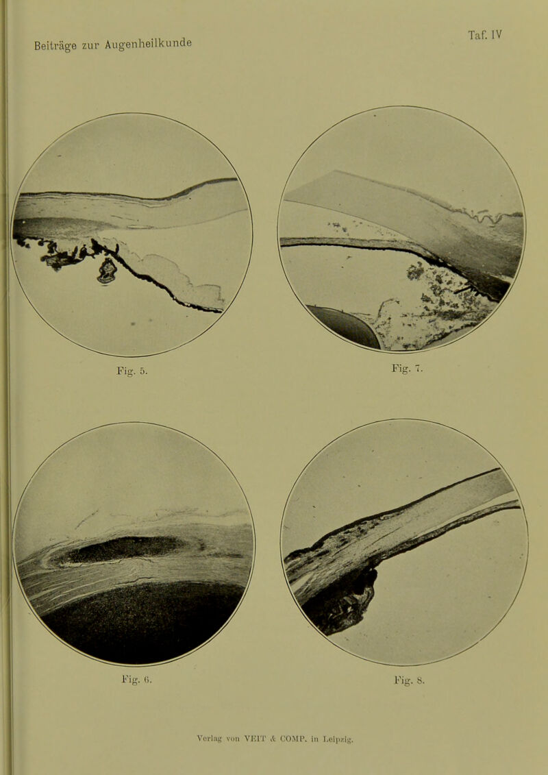 Beiträge zur Augenheilkunde Taf. IV