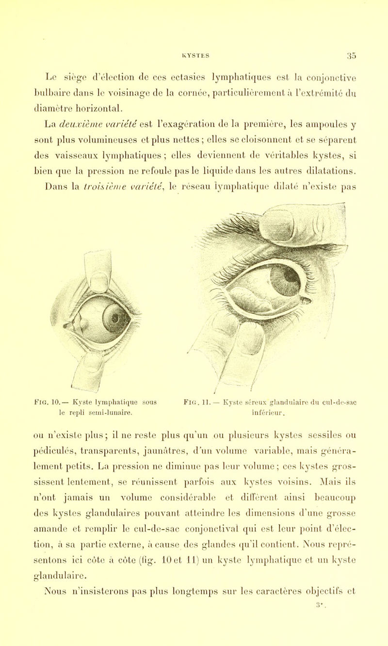 Le siège d'élection de ces ectasies lymphatiques est la conjonctive bulbaire dans le voisinage de la cornée, particulièrement à l'extrémité du diamètre horizontal. La deuxième variété est l'exagération de la première, les ampoules y sont plus volumineuses et plus nettes ; elles se cloisonnent et se séparent des vaisseaux lymphatiques ; elles deviennent de véritables kystes, si bien que la pression ne refoule pas le liquide dans les autres dilatations. Dans la troisième variété, le réseau lymphatique dilaté n'existe pas Fig. 10.— Kyste lymphatique sous Fig. 11.— Kyste séreux glandulaire du cul-de-sac le repli semi-lunaire. inférieur. ou n'existe plus ; il ne reste plus qu'un ou plusieurs kystes sessiles ou pédiculés, transparents, jaunâtres, d'un volume variable, mais généra- lement petits. La pression ne diminue pas leur volume; ces kystes gros- sissent lentement, se réunissent parfois aux kystes voisins. Mais ils n'ont jamais un volume considérable et diffèrent ainsi beaucoup des kystes glandulaires pouvant atteindre les dimensions d'une grosse amande et remplir le cul-de-sac conjonctival qui est leur point d'élec- tion, à sa partie externe, à cause des glandes qu'il contient. Nous repré- sentons ici côte à côte (fig. 10 et 11) un kyste lymphatique et un kyste glandulaire. Nous n'insisterons pas plus longtemps sur les caractères objectifs et 3*.