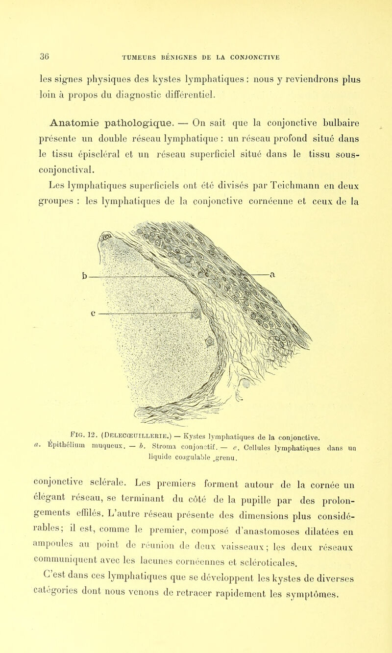 les signes physiques des kystes lymphatiques : nous y reviendrons plus loin à propos du diagnostic différentiel. Anatomie pathologique. — On sait que la conjonctive bulbaire présente un double réseau lymphatique : un réseau profond situé dans le tissu épiscléral et un réseau superficiel situé dans le tissu sous- conjonctival. Les lymphatiques superficiels ont été divisés par Teichmann en deux groupes : les lymphatiques de la conjonctive cornéenne et ceux de la Fig. 12. (Delecœdtllerie.) - Kystes lymphatiques de la conjonctive. a. Epithéliuin muqueus. - b. Stroma conjonctif. — c. Cellules lymphatiques clans un liquide coagulable .grenu. conjonctive sclérale. Les premiers forment autour de la cornée un élégant réseau, se terminant du côté de la pupille par des prolon- gements effilés. L'autre réseau présente des dimensions plus considé- rables; il est, comme le premier, composé d'anastomoses dilatées en ampoules au point de réunion de deux vaisseaux; les deux réseaux communiquent avec les lacunes cornéennes et scléroticales. C'est dans ces lymphatiques que se développent les kystes de diverses catégories dont nous venons de retracer rapidement les symptômes.