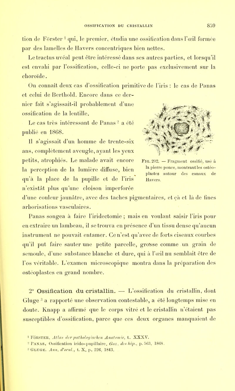 tion de Fôrster 1 qui, le premier, étudia une ossification dans l'œil formée par des lamelles de Havers concentriques bien nettes. Letractus uvéal peut être intéressé dans ses autres parties, et lorsqu'il est envahi par l'ossification, celle-ci ne porte pas exclusivement sur la choroïde. On connaît deux cas d'ossification primitive de l'iris : le cas de Panas et celui de Berthold. Encore dans ce der- nier fait s'agissait-il probablement d'une ossification de la lentille. Le cas très intéressant de Panas2 a été publié en 1868. Il s'agissait d'un homme de trente-six ans, complètement aveugle, ayant les yeux petits, atrophiés. Le malade avait encore la perception de la lumière diffuse, bien qu'à la place de la pupille et de l'iris n'existât plus qu'une cloison imperforée d'une couleur jaunâtre, avec des taches pigmentaires, et çà et là de fines arborisations vasculaires. Panas songea à faire l'iridectomie ; mais en voulant saisir l'iris pour en extraire un lambeau, il se trouva en présence d'un tissu dense qu'aucun instrument ne pouvait entamer. Ce n'est qu'avec de forts ciseaux courbes qu'il put faire sauter une petite parcelle, grosse comme un grain de semoule, d'une substance blanche et dure, qui à l'œil nu semblait être de l'os véritable. L'examen microscopique montra dans la préparation des ostéoplastes en grand nombre. 2° Ossification du cristallin. — L'ossification du cristallin, dont Gluge :! a rapporté une observation contestable, a été longtemps mise en doute. Knapp a affirmé que le corps vitré et le cristallin n'étaient pas susceptibles d'ossification, parce que ces deux organes manquaient de 1 Forster. Atlas der pathologisehen Anatomie, t. XXXV. '-' Panas. Ossification irido-pupillaire. Gaz. deshôp., p. 563, 180S. -Glugis. A/iii. d'ocui., t. X, p. 226, 1843. FlG. 202. — Fragment ossifié, usé à la pierre ponce, montrant les ostéo- plastes autour des canaux de Havers.