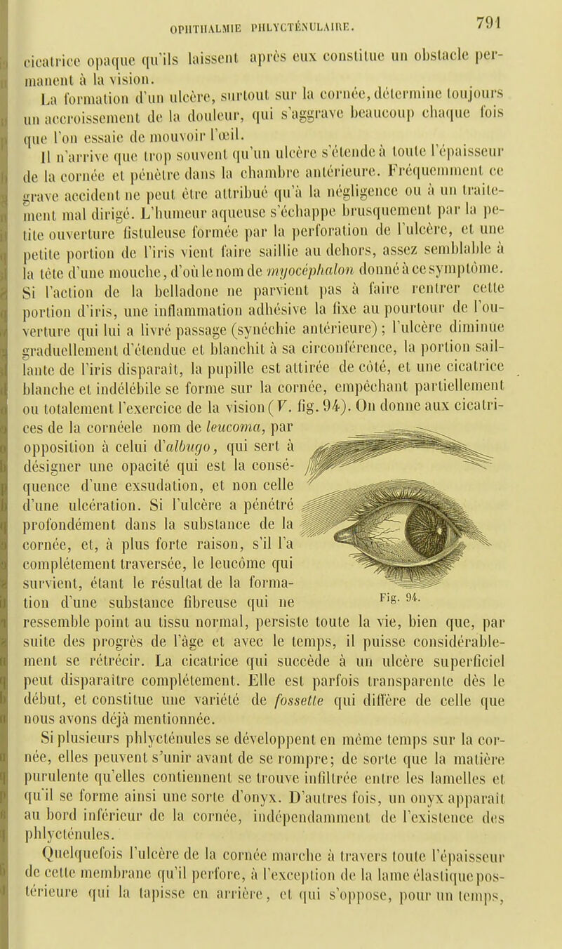 .•icall'ic'o opaque qu'ils laissent après eux constitue un obstacle per- manent à la vision. La formation d'un ulcère, surtout sur la cornée, détermine toujours un accroissement de la douleur, qui s'aggrave beaucouj) cluKiue lois (jue Ton essaie de mouvoir roeil. 11 n'arrive que trop souvent qu'un ulcère s'étende à toute l'épaisseur de la cornée et pénètre dans la chambre antérieure. Fréquenunent ce i^rave accident ne peut être attribué qu'à la lu'gligence ou à un traite- ment mal dirigé. L'humeur aqueuse s'échappe brusqueinenl par la i)e- lite ouverture lisluleuse formée par la perforation de l'ulcère, et une petite portion de l'iris vient faire saillie au dehors, assez semblable à la tète d'une mouche, d'où le nom de myocéplialon donné à ce symptôme. Si l'action de la belladone ne parvient i)as à faire rentrer cette |)orlion d'iris, une inflammation adhésive la fixe au pourtour de l'ou- Ncrture qui lui a livré passage (synéchie antérieure) ; l'ulcère diminue ivraducllemenl d'étendue et blanchit à sa circonférence, la portion sail- lante de l'iris disparaît, la pupille est attirée de côté, et une cicatrice i)lanche et indélébile se forme sur la cornée, empêchant partiellement ou totalement l'exercice de la vision (F. fig. 94). On donne aux cicatri- ces de la cornéele nom de leucoma, par opposition à celui {ïalbugo, qui sert à désigner une opacité qui est la consé- quence d'une exsudation, et non celle d'une ulcération. Si l'ulcère a pénétré profondément dans la substance de la cornée, et, à plus forte raison, s'il l'a complètement traversée, le leucôme qui survient, étant le résultat de la forma- tion d'une substance fibreuse qui ne ressemble point au tissu normal, persiste toute la vie, bien que, par suite des progrès de l'âge et avec le temps, il puisse considérable- ment se rétrécir. La cicatrice qui succède à un ulcère superficiel peut disparaître complètement. Elle est parfois transparente dès le début, et constitue une variété de fossette qui diifère de celle que nous avons déjà mentionnée. Si plusieurs phlycténules se développent en même temps sur la cor- née, elles peuvent s'unir avant de se rompre; de sorte que la matière purulente qu'elles contiennent se trouve infiltrée entre les lamelles et quil se forme ainsi une sorte d'onyx. D'autres fois, un onyx apparaît au bord inférieur de la cornée, iiulépendamment de l'existence des phlycténules. Quelquefois l'ulcère de la coi'uée marche à ti'avers toute l'épaisseur de celle membrane qu'il pei-fore, à rexcei)tion de la lame élastique pos- térieure qui la tapisse en arrière, cl qui s'oppose, pour un temps,