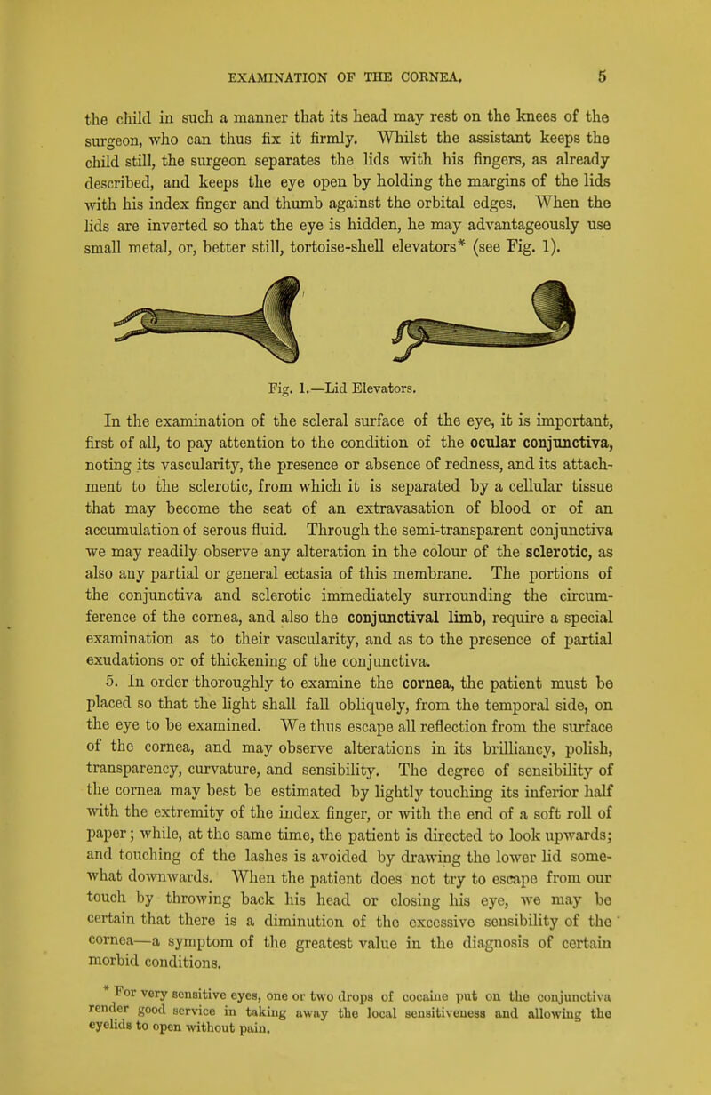 the child in such a manner that its head may rest on the knees of the surgeon, who can thus fix it firmly. Whilst the assistant keeps the child still, the surgeon separates the lids with his fingers, as already described, and keeps the eye open by holding the margins of the lids with his index finger and thumb against the orbital edges. When the lids are inverted so that the eye is hidden, he may advantageously use small metal, or, better still, tortoise-shell elevators* (see Fig. 1). Fig. 1.—Lid Elevators, In the examination of the scleral surface of the eye, it is important, first of all, to pay attention to the condition of the ocular conjunctiva, noting its vascularity, the presence or absence of redness, and its attach- ment to the sclerotic, from which it is separated by a cellular tissue that may become the seat of an extravasation of blood or of an accumulation of serous fluid. Through the semi-transparent conjunctiva we may readily observe any alteration in the colour of the sclerotic, as also any partial or general ectasia of this membrane. The portions of the conjunctiva and sclerotic immediately surrounding the circum- ference of the cornea, and also the conjunctival limb, require a special examination as to their vascularity, and as to the presence of partial exudations or of thickening of the conjunctiva. 5. In order thoroughly to examine the cornea, the patient must be placed so that the light shall fall obliquely, from the temporal side, on the eye to be examined. We thus escape all reflection from the surface of the cornea, and may observe alterations in its brilliancy, polish, transparency, curvature, and sensibility. The degree of sensibility of the cornea may best be estimated by lightly touching its inferior half with the extremity of the index finger, or with the end of a soft roll of paper; while, at the same time, the patient is directed to look upwards; and touching of the lashes is avoided by drawing the lower lid some- what downwards. When the patient does not try to escape from our touch by throAving back his head or closing his eye, we may bo certain that there is a diminution of the excessive sensibility of the ' cornea—a symptom of the greatest value in the diagnosis of certain morbid conditions. * For very sensitive eyes, one or two droits of cocaine put on the conjunctiva render good service in taking away the local sensitiveness and allowing the eyelids to open without pain.