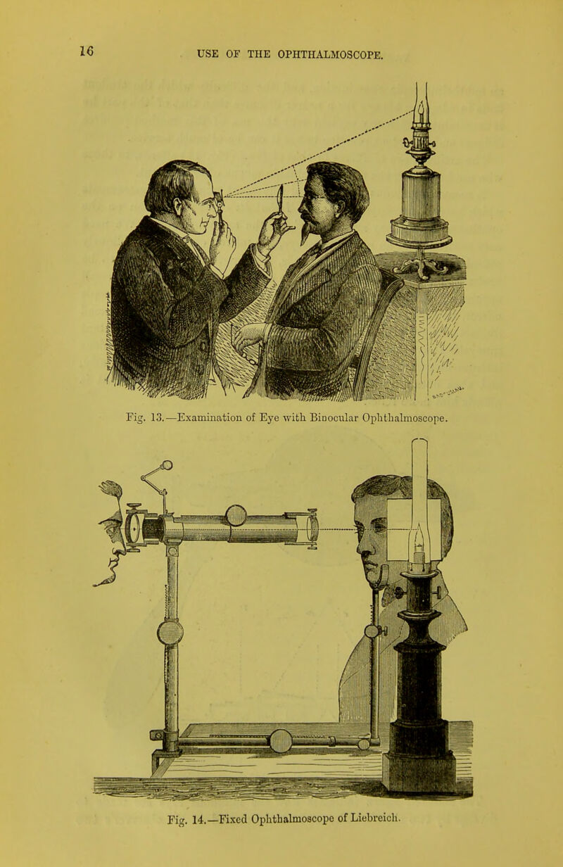 Pig. 14.—Fixed Ophthalmoscope of Liebreich.