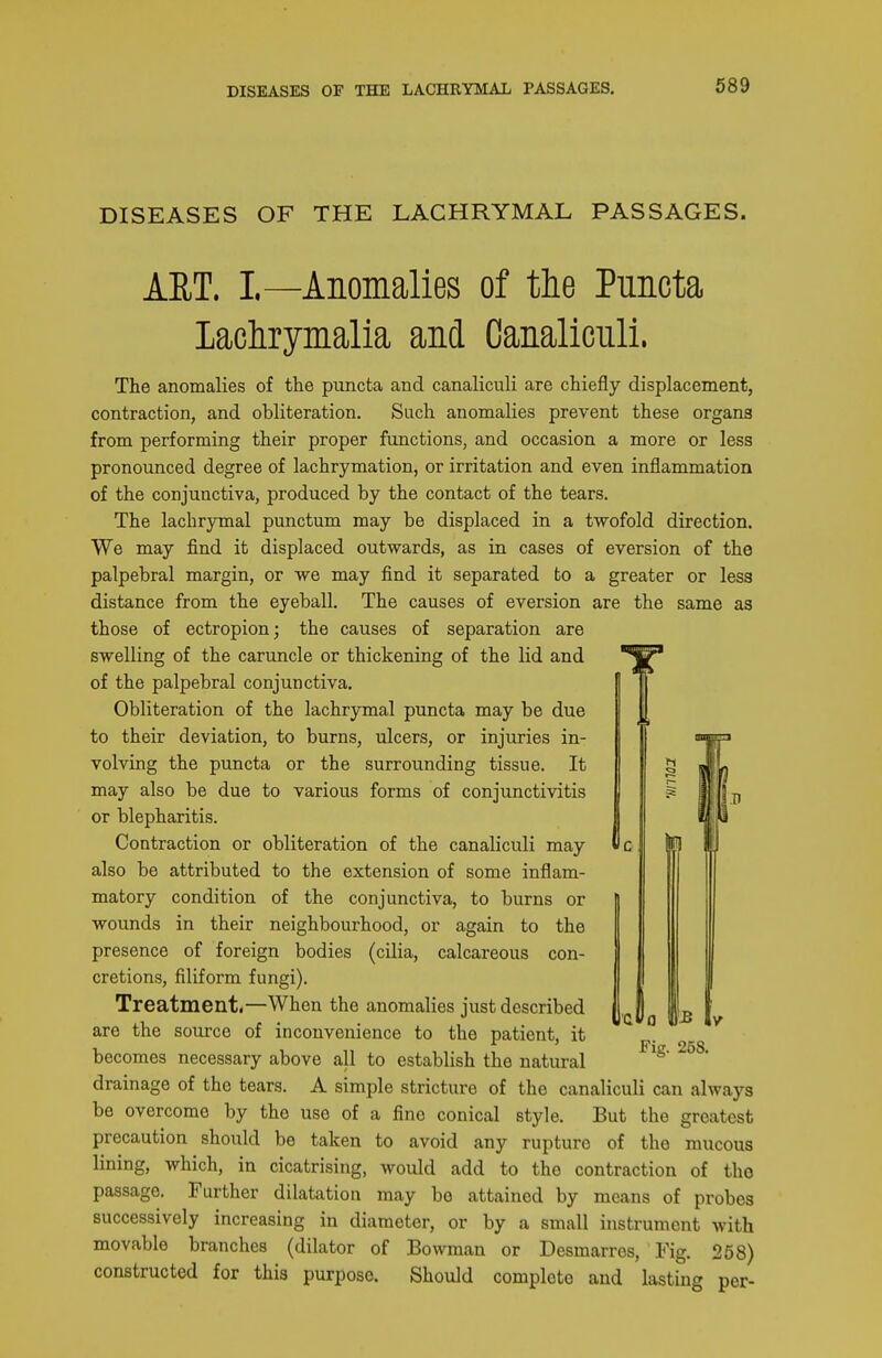 DISEASES OF THE LACHRYMAL PASSAGES. DISEASES OF THE LACHRYMAL PASSAGES. ART. L—Anomalies of tlie Puncta lachrymalia and Canaliculi. The anomalies of the puncta and canaliculi are chiefly displacement, contraction, and obliteration. Such anomalies prevent these organs from performing their proper functions, and occasion a more or less pronounced degree of lachrymation, or irritation and even inflammation of the conjunctiva, produced by the contact of the tears. The lachrymal punctum may be displaced in a twofold direction. We may find it displaced outwards, as in cases of eversion of the palpebral margin, or we may find it separated to a greater or less distance from the eyeball. The causes of eversion are the same as those of ectropion; the causes of separation are swelling of the caruncle or thickening of the lid and of the palpebral conjunctiva. Obliteration of the lachrymal puncta may be due to their deviation, to burns, ulcers, or injuries in- volving the puncta or the surrounding tissue. It may also be due to various forms of conjunctivitis or blepharitis. Contraction or obliteration of the canaliculi may also be attributed to the extension of some inflam- matory condition of the conjunctiva, to burns or wounds in their neighbourhood, or again to the presence of foreign bodies (cilia, calcareous con- cretions, filiform fungi). Treatment,—When the anomalies just described are the source of inconvenience to the patient, it becomes necessary above all to establish the natural drainage of the tears. A simple stricture of the canaliculi can always be overcome by the use of a fine conical style. But the greatest precaution should be taken to avoid any rupture of the mucous lining, which, in cicatrising, would add to the contraction of the passage. Further dilatation may be attained by means of probes successively increasing in diameter, or by a small instrument with movable branches (dilator of Bowman or Desmarres, Fig. 258) constructed for this purpose. Should complete and lasting per-