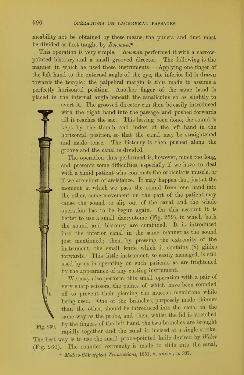meability not be obtained by these means, the puncta and duct must be divided as first taught by Bowman* This operation is very simple. Bowman performed it ^vith a narrow- pointed bistoury and a small grooved director. The following is the manner in which he used these instruments :—Applying one finger of the left hand to the external angle of the eye, the inferior lid is drawn towards the temple; the palpebral margin is thus made to assume a perfectly horizontal position. Another finger of the same hand is placed in the internal angle beneath the canaliculus so as slightly to evert it. The grooved director can then be easily introduced Iwith the right hand into the passage and pushed forwards till it reaches the sac. This having been done, the sound is kept by the thumb and index of the left hand in the horizontal position, so that the canal may be straightened and made tense. The bistoury is then pushed along the groove and the canal is divided. The operation thus performed is, however, much too long, and presents some difficulties, especially if we have to deal with a timid patient who contracts the orbicularis muscle, or if we are short of assistance. It may happen that, just at the moment at which we pass the sound from one hand into the other, some movement on the part of the patient may cause the sound to slip out of the canal, and the whole operation has to be begun again. On this account it is better to use a small dacryotome (Fig. 259), in which both the sound and bistoury are combined. It is introduced into the inferior canal in the same manner as the sound just mentioned; then, by pressing the extremity of the instrument, the small knife which it contains (h) glides forwards. This little instrument, so easily managed, is still used by us in operating on such patients as are frightened by the appearance of any cutting instrument. We may also perform this small operation with a pair of very sharp scissors, the points of which have been rounded off to prevent their piercing the mucous membrane while being used. One of the branches, purposely made thinner than the other, should be introduced into the canal in the same way as the probe, and then, whilst the lid is stretched by the fingers of the left hand, the two branches are brought rapidly together and the canal is incised at a single stroke. The best way is to use the small probe-pointed knife devised by JVchcr (Fig. 2GO). The rounded extremity is made to slide into the canal, * Medico-Chirurgical Transactions, 1851, v. xxxiv., p. 337.