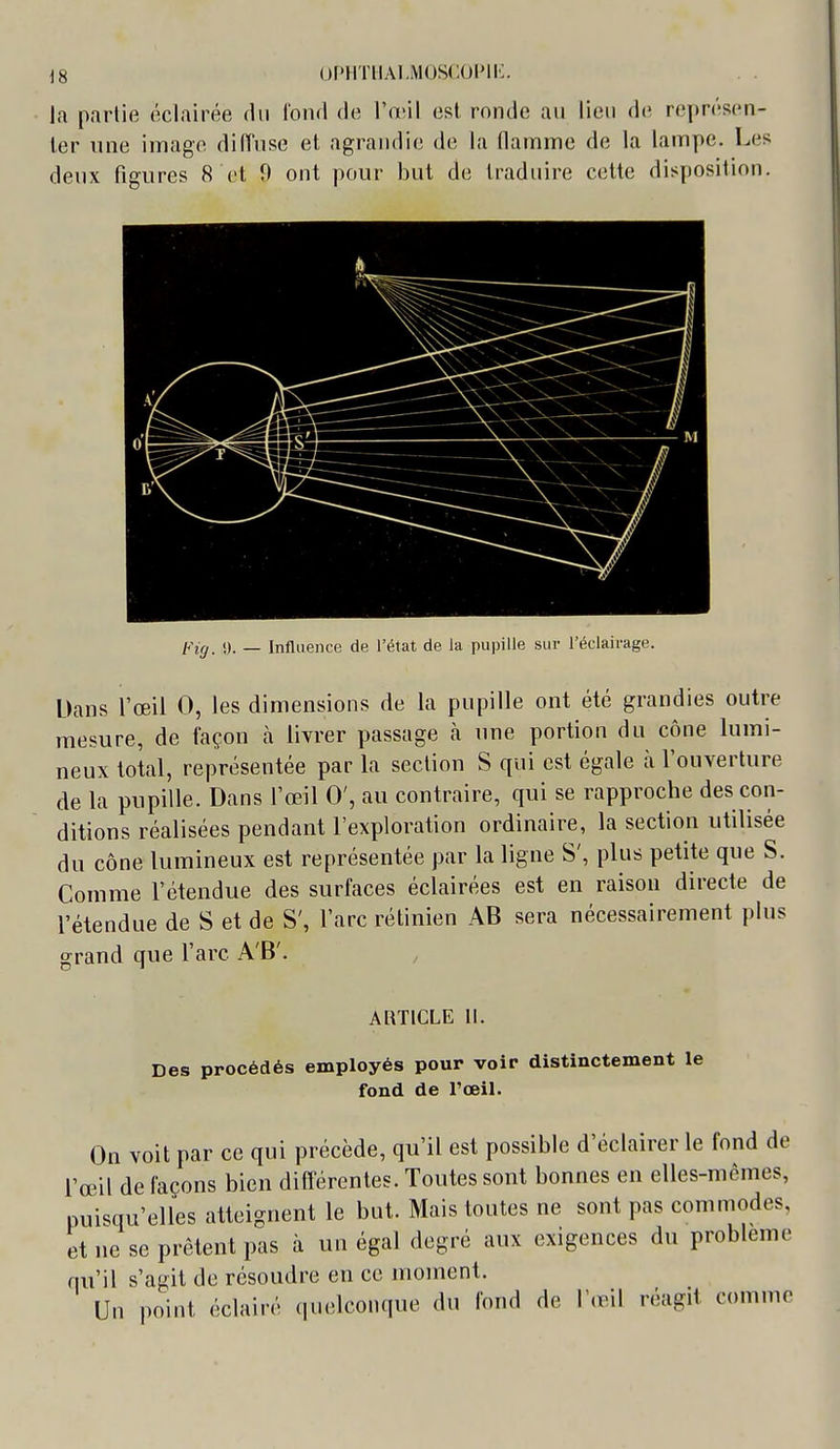 Uf>HTllAl.M0S(:01Mi:. la partie éclairée du lonfi de l'anl est ronde au lien de représen- ter une image dilVuse et agrandie de la flamme de la lampe. Les deux figures 8 et 9 ont pour but de traduire cette disposition. J). _ Influence de l'état de la pupille sur l'éclairage. Dans l'œil 0, les dimensions de la pupille ont été grandies outre mesure, de façon à livrer passage h. une portion du cône lumi- neux total, représentée par la section S qui est égale à l'ouverture de la pupille. Dans l'œil 0', au contraire, qui se rapproche des con- ditions réalisées pendant l'exploration ordinaire, la section utilisée du cône lumineux est représentée par la ligne S', plus petite que S. Comme l'étendue des surfaces éclairées est en raison directe de l'étendue de S et de S', l'arc rétinien AB sera nécessairement plus grand que l'arc A'B'. ARTICLE II. Des procédés employés pour voir distinctement le fond de l'oeil. On voit par ce qui précède, qu'il est possible d'éclairer le fond de fœil de façons bien différentes. Toutes sont bonnes en elles-mêmes, puisqu'elles atteignent le but. Mais toutes ne sont pas commodes, et ne se prêtent pas à un égal degré aux exigences du problème qu'il s'agit de résoudre en ce moment. Un point éclairé quelconque du fond de l'œil réagit comme