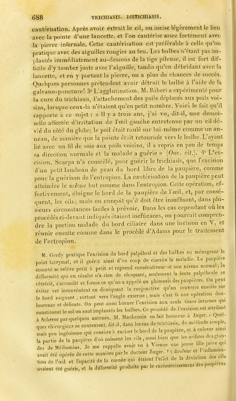 cautérisation. Après avoir extrait le cil, oq incise légèrement le lieu avec la pointe d'une lancette, et l'on cautérise assez fortement avec la pierre infernale. Cette cautérisation est préférable à celle qu'on pratique avec des aiguilles rougies au feu. Les bulbes n'étant pas im- plantés immédiatement au-clessons de la tige pileuse, il est fort dif- ficile d'y tomber juste avec l'aiguille, tandis qu'en débridant avec la lancette, et en y portant la pierre, on a plus de chances de succès. Quelques personnes prétendent avoir détruit le bulbe à l'aide de la galvano-poncture! 3» L'agglutination. M.Riberi a expérimenlé pour la cure du trichiasis, l'attacbement des poils déplacés aux poils voi- sins, lorsque ceux-là n'étaient qu'en petit nombre. Voici le fait qu'il rapporte à ce sujet : « 11 y a trois ans, j'ai vu, dit-il, une demoi- selle affectée d'irritation de l'œil gauche entretenue par un cil dé- vié du côté du globe; le poil était roulé sur lui-même comme un an- neau, de manière que la pointe était retournée vers le bulbe. L'ayant lié avec un fil de soie aux poils voisins, il a repris en peu de temps sa direction normale et la malade a guérie » [Oiw. cit.). 4° L'ex- cision. Scavpa n'a conseillé, pour guérir le tricbiasis, que l'excision d'un petit lambeau de peau du bord libre de la paupière, comme pour la guérison de l'entropion. La cautérisation de la paupière peut atteindre le même but comme dans l'entropion. Celte opération, ef- fectivement, éloigne le bord de la paupière de l'œil, et, par consé- quent, les cils ; mais on conçoit qu'il doit être insuffisant, dans plu- sieurs circonstances faciles à prévoir. Dans les cas cependant oii les procédés ci-devant indiqués étaient inefficaces, on pourrait compren- dre la portion malade du bord ciliaire dans une incision en V, et réunir ensuite comme dans le procédé d'Adams pour le traitement de l'ectropîon. M Gerdv pratique l'excision du bord palpébral et des bulbes en ménageant le point lacrymal, et il guérit ainsi d'un coup de ciseau.x la maladie. La paup.cre ccûurié se relève petit à petit et reprend consécutivement son niveau normal; la difformité qui en résulte n'a rien de choquant, seulement la fente palpebiale se rétrécit, s'arrondit ei forme ce qu'on a appelé un phimosis des paup.cres. On peut éviter cet inconvénient en disséquaut la conjonctive qu'on renverse ensuite sur le bord saignant , surtout vers l'angle externe ; mais c'est Ih «ne opération dou- loureuse et délicate. On peut aussi borner l'excision aux seuls tissus internes quj constituent le sol ou sont implantés les bulbe.. Ce procédé de l'excision est attribue à Sclicrer par.quelques auteurs. M. Wackenzie en fait bonneur a J.^ger.Que - ques chirurgien, se contentent, dit-il, dans les cas de t richiasis, de  ^ -M'^ mais peu ingénieuse qui consiste à exci.er le bord de la paupière, et la partie de la pauplJre d'où naissent les cils , aussi bien que les or.fices descL.n- lï de Méibondus.' Je me rappelle avoir vu à Vienne une ^^^^^IZ avait été opérée de cette manière par le docteur Jœger r . douleur ,iôn de l'œil et l'opacité de la cornée qui étaient l'eiret de '^'^^^^^^'^'^^^^^^^^ avaient été guéris, et la difformité produite par le raccourcssemenl de» paupu