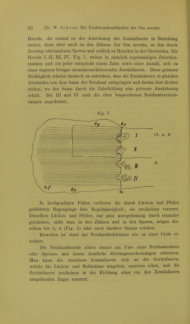 1 Kunde, die einmal zu der Anordnung der Zonulafasern in Beziehung stehen, dann aber auch zu den Zähnen der Ora serrata, zu den durcli Zerrung entstandenen Sporen und endlich zu Heerden in der Chorioidea. Die Heerde I, II, III, IV, Fig. 7, stehen in ziemlich regelmässigen Zwischen- räumen und ein jeder entspricht einem Zahn sowie einer Anzahl, sich zu einer engeren Gruppe zusammenschliessender Zonulafasern. Diese grössere Dichtigkeit scheint dadurch zu entstehen, dass die Zonulafasern in gleichen Abständen von dem Saum der Netzhaut entspringen und darum dort dichter stehen, wo der Saum durch die Zahnbildung eine grössere Ausdehnung erhält. Bei III und IY sind die eben besprochenen Netzhautverände- rungen angedeutet. Fig. 7. In hochgradigen Fällen verlieren die durch Lücken und Pfeiler gebildeten Bogengänge ihre Regelmässigkeit; sie erscheinen verzerrt. Dieselben Lücken und Pfeiler, nur ganz unregelmässig durch einander geschoben, sieht man in den Zähnen und in den Sporen, mögen die- selben bis 3, 4 (Fig. 2) oder noch darüber hinaus reichen. Bisweilen ist einer der Netzhauthohlräume wie zu einer Cyste er- weitert. Die Netzhautheerde sitzen immer am Fuss eines Netzhautzahnes oder Spornes und lassen deutliche Zerrungserscheinungen erkennen. Man kann die einzelnen Zonulafasern sich an die Gerüstfasern, welche die Lücken und Hohlräume umgeben, ansetzen sehen, und die Gerüstfasern erscheinen in der Richtung eines von den Zonulafasern ausgehenden Zuges verzerrt.