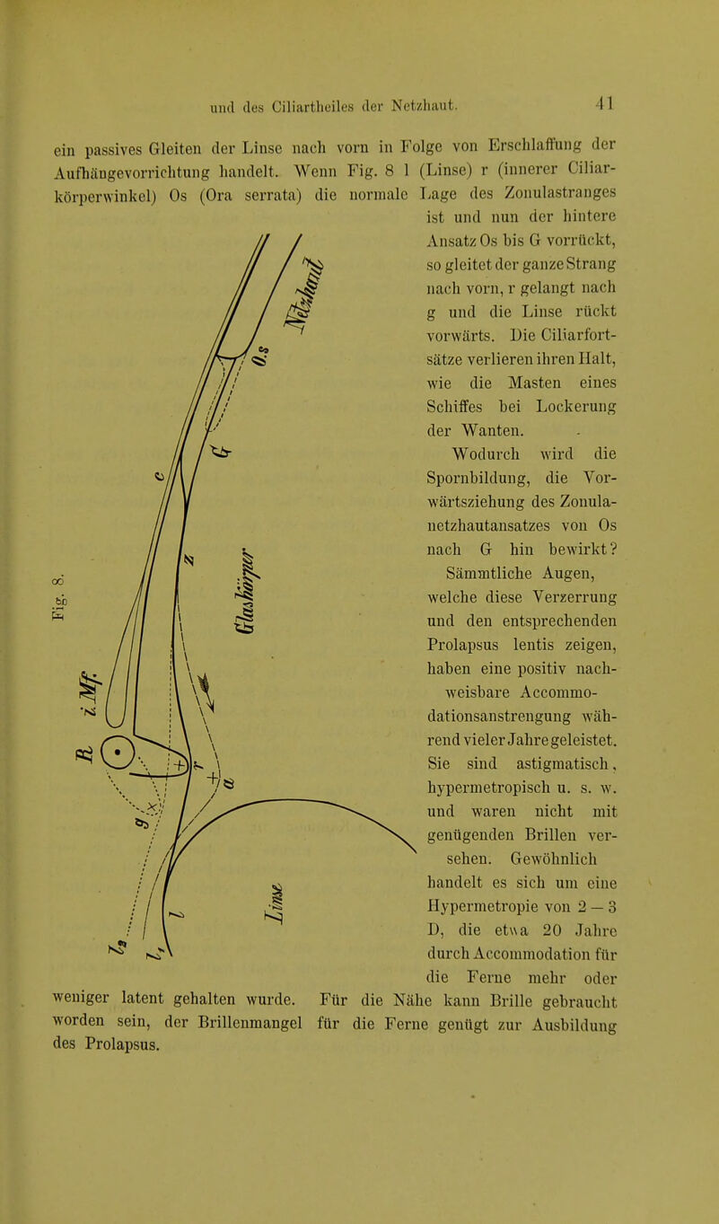 ein passives Gleiten der Linse nach vorn in Folge von Erschlaffung der Aufhängevorrichtung handelt, Wenn Fig. 8 1 (Linse) r (innerer Oiliar- körperwinkel) Os (Ora serrata) die normale Lage des Zonulastranges ist und nun der hintere Ansatz Os bis G vorrückt, so gleitet der ganze Strang nach vorn, r gelangt nach g und die Linse rückt vorwärts. Die Ciliarfort- sätze verlieren ihren Halt, wie die Masten eines Schiffes bei Lockerung der Wanten. Wodurch wird die Spornbildung, die Vor- wärtsziehung des Zonula- netzhautansatzes von Os nach G hin bewirkt? Sämmtliche Augen, welche diese Verzerrung und den entsprechenden Prolapsus lentis zeigen, haben eine positiv nach- weisbare Accommo- dationsanstrengung wäh- rend vieler Jahre geleistet. Sie sind astigmatisch. hypermetropisch u. s. w. und waren nicht mit genügenden Brillen ver- sehen. Gewöhnlich handelt es sich um eine Hypermetropie von 2 — 3 D, die etwa 20 Jahre durch Accommodation für die Ferne mehr oder weniger latent gehalten wurde. Für die Nähe kann Brille gebraucht worden sein, der Brillenmangel für die Ferne genügt zur Ausbildung des Prolapsus.