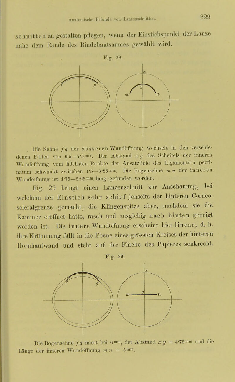 Anatomische Befunde von Lanzenschnitten. schnitten zu gestalten pflegen, wenn der Einsticlispunkt der Lanze nahe dem Kunde des Bindehautsaumes gewählt wird. • Fig. 28. X \\ / nv —>. ) v Die Sehne fg der äusserenWundöffnung wechselt in den verschie- denen Fällen von 6-5— 7-5 mm. Der Abstand xy des Scheitels der inneren Wundöffnung vom höchsten Punkte der Ansatzlinie des Ligamentum pecti- natum schwankt zwischen 1-5—3-25mm. Die Bogensehne mn der inneren Wundöffnung ist 4-75—5-25 mm iailg gefunden worden. Fiff. 29 bring,! einen Lanzenschnitt zur Anschauung, bei welchem der Einstich sehr schief jenseits der hinteren Corneo- seleralgrenze gemacht, die Klingenspitze aber, nachdem sie die Kammer eröffnet hatte, rasch und ausgiebig nach hinten geneigt worden ist. Die innere Wundöffnung erscheint hier linear, d.h. ihre Krümmung fällt in die Ebene eines grössten Kreises der hinteren Hornhautwand und steht auf der Fläche des Papieres senkrecht. Fig. 29. Die Bogensehne fg missf bei Gmm; der Abstand xy = 4-75» und die Länge der inneren Wundöffnung m v = 5>nm.