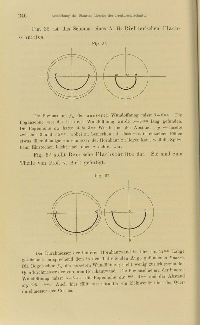 Fig. 30 ist das Schema eines A. G. Richter'schen Flach - Schnittes. Fig. 36. Ii r q \\ 1 TU J) Die Bogensehne /'(/ der äusseren Wundöffnung inisst 7—8mm. Die Bogensehne mn der inneren Wundöffnuug wurde 5—6 mm ]ang gefunden. Die Bogenhöhe cx hatte stets 3 mm Werth und der Abstand xy wechselte zwischen 3 und 3-5wobei zu bemerken ist, dass mn in einzelnen Fällen etwas über dem Querdurchmesser der Hornhaut zu liegen kam, weil die Spitze beim Einstechen leicht nach oben gerichtet war. Fig. 37 stellt Beer'sche Flachschnitte dar. Sie sind zum Theile von Prof. v. Arlt gefertigt. Fig. 37. f c rv \ J) 7 Der Durchmesser der hinteren Hornhautwand ist hier mit 12 nun Länge gezeichnet, entsprechend dem in dem betreffenden Auge gefundenen Maasse. Die Bogensehne fg der äusseren Wundöffnuug steht wenig zurück gegen den Querdurchmesser der vorderen Hornhautwand. Die Bogensehne mn der inneren Wundöffnung misst 6-8m% die Bogenhöhe cx 2-5-4'-. und der Abstand xy 2-5—4mm. Auch hier fällt mn mitunter ein kleinwenig über den Quer- durchmesscr der Cornea.