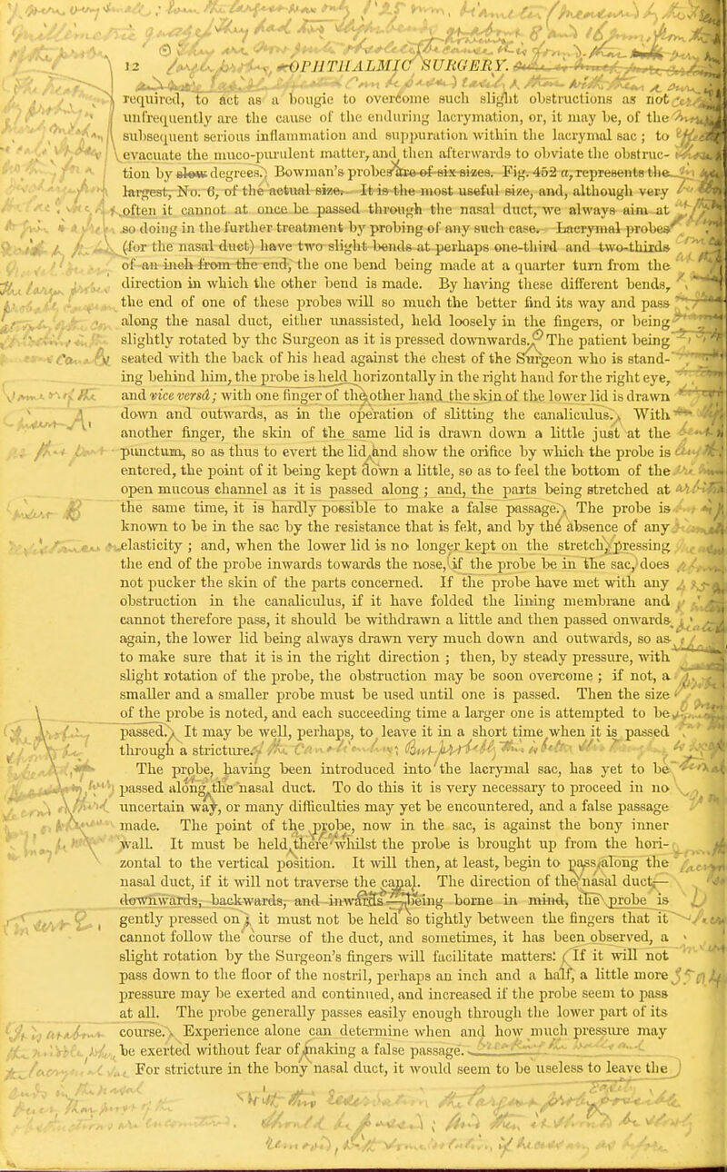 required, to act as a bougie to overcome such slight obstructions as not£tt<g| unfrequently are the cause of the enduring lacrymation, or, it may lie, of the^v subsequent serious inflammation and suppuration within the lacrymal sac ; to evacuate the muco-purulent matter,and then afterwards to obviate the obstruc- tion by sAevi degrees.; Bowman's probes^tte^f-eix-skes. Fig. 452 a, represents the?; largest, No. (i, of the actual sine.-. It is the most useful size, and, although very ' ■ often it cannot at once be passed through the nasal duct, we always aim at ^ • aJu\\ jso doing in the4urther-teeatment-by probing of any such case, tacrymal probes^/ •X t'jf J, AxMitJ:^01 tne nasa^ duct) have two slight bends at perhaps one-third and two-third* ,' of an inch from the end, the one bend being made at a cpiarter turn from the direction in which the other bend is made. By having these different bends, the end of one of these probes will so much the better find its way and pass along the nasal duct, either unassisted, held loosely in the fingers, or beingJ slightly rotated by the Surgeon as it is pressed downwards^ The patient being •« £'Oi ». tx seated with the back of his head against the chest of the Surgeon who is stand- ing behind him, the probe is held horizontally in the right hand for the right eye, and vice vcrsd; with one ringer of thaother hand the skin of the lower lid is drawn down and outwards, as in the operation of slitting the canaliculus^ With another finger, the skin of the same lid is drawn down a little just at the ' ' punctilio, so as thus to evert the lid^and show the orifice by which the probe is c^-t'^n entered, the point of it being kept clown a little, so as to feel the bottom of the ' open mucous channel as it is passed along; and, the parts being stretched sX^^ilm Ljnxbsr- $ same time, it is hardly possible to make a false passage. > The probe is known to be in the sac by the resistance that is felt, and by the' absence of any •..elasticity; and, when the lower lid is no longer kept on the stretch, pressing , the end of the probe inwards towards the nose,'if the probe be in the sac, does not pucker the skin of the parts concerned. If the probe have met with any obstruction in the canaliculus, if it have folded the lining membrane and cannot therefore pass, it should be withdrawn a little and then passed onwards again, the lower lid being always drawn very much down and outwards, so as 7~7j| to make sure that it is in the right direction ; then, by steady pressure, with slight rotation of the probe, the obstruction may be soon overcome ; if not, a smaller and a smaller probe must be used until one is passed. Then the size <y ^1 \ of the probe is noted, and each succeeding time a larger one is attempted to he ' f># passed^ It may be well, perhaps, to leave it in a short time when it is passed ^llSsi^J through a stricture^/fhrCA►»&»4-ltf{<U)*<U>* K -V The probe, ha^urg been introduced into'the lacrymal sac, has yet to be . ' passed along,the nasal duct. To do this it is very necessary to proceed in no , i uncertain way, or many difficulties may yet be encountered, and a false passage made. The point of the probe, now in the sac, is against the bony inner The point of the probe, now in wall. It must be held^thei^whilst the probe is brought up from the hori- zontal to the vertical position. It will then, at least, begin to pass,along the k nasal duct, if it will not traverse the canaL The direction of thej'nasal duct— downwards, backwards, and inwarcts -^being borne in mind, tEe\probe is gently pressed on i it must not be held so tightly between the fingers that it cannot follow the' course of the duct, and sometimes, it has been observed, a < slight rotation by the Surgeon's fingers will facilitate matters: ( If it will not pass down to the floor of the nostril, perhaps an inch and a half, a little more t' pressure may be exerted and continued, and increased if the probe seem to pass at all. The probe generally passes easily enough through the lower part of its course.. Experience alone can determine when and how much pressure may v t ■',,: ■ - ;./, r be exerted without fear of^naking a false passage. - *f~&t*~C For stricture in the bony nasal duct, it would seem to be useless to leave the)