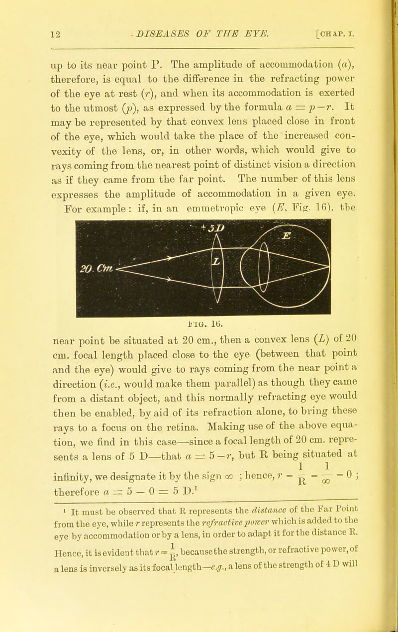 up to its near point P. The amplitude o£ accommodation («), therefore, is equal to the difference in the refracting power of the eye at rest (?•), and when its accommodation is exerted to the utmost (p), as expressed by the formula a = It may be represented by that convex lens placed close in front of the eye, which would take the place of the increased con- vexity of the lens, or, in other words, which would give to rays coming from the nearest point of distinct vision a direction as if they came from the far point. The number of this lens expresses the amplitude of accommodation in a given eye. For example: if, in an emmetropic eye {Fj. Fia:. 16), the i'lG. lb. near point be situated at 20 cm., then a convex lens {L) of 20 cm. focal length placed close to the eye (between that point and the eye) would give to rays coming from the near point a direction (i.e., would make them parallel) as though they came from a distant object, and this normally refracting eye wovild then be enabled, by aid of its refraction alone, to bring these rays to a focus on the retina. Making use of the above equa- tion, we find in this case—since a focal length of 20 cm. repre- sents a lens of 5 D—that a = 5 -r, but R being situated at 1 1 infinity, we designate it by the sign oo ; hence, r = - therefore a = 5 - 0 = 5 D.' — = 0 00 ' It must be observed that R represents the distance of the Far Point from the 63-6, while r represents the refractive jidvor which is added to the eye by accommodation or by a lens, in order to adapt it for the distance R. Hence, it is evident that r ■= ^, because the strength, or refractive power, of a lens is inversely as its f ocaUength—e.j/., a lens of the strength of 4 D will
