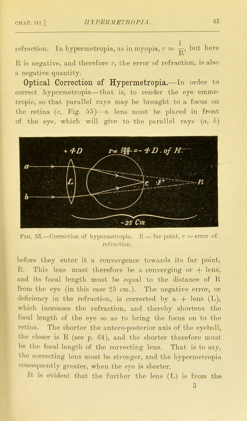 retraction. In hypermetropia, as in myopia, r — p-, bnt here B is negative, and therefore r, the error of refraction, is also a negative quantity. Optical Correction of Hypermetropia.—In order to correct hypermetropia—that is, to render the eye emme- tropic, so that parallel rays may be brought to a focus on the retina (c, Fig. 55)—a lens must be placed in front of the eye, which will give to the parallel rays (a, b) Fig. 55.—Correction of hypermetropia. R = far point, r = error of refraction. before they enter it a convergence towards its far point, R. This lens must therefore be a converging or + lens, and its focal length must be equal to the distance of R from the eye (in this case 25 cm.). The negative error, or deficiency in the refraction, is corrected by a + lens (L), which increases the refraction, and thereby shortens the focal length of the eye so as to bring the focus on to the retina. The shorter the antero-posterior axis of the eyeball, the closer is R (see p. 64), and the shorter therefore must he the focal length of the correcting lens. That is to say, the correcting lens must be stronger, and the hypermetropia Consequently greater, when the eye is shorter. It is evident that the further the lens (L) is from the 5